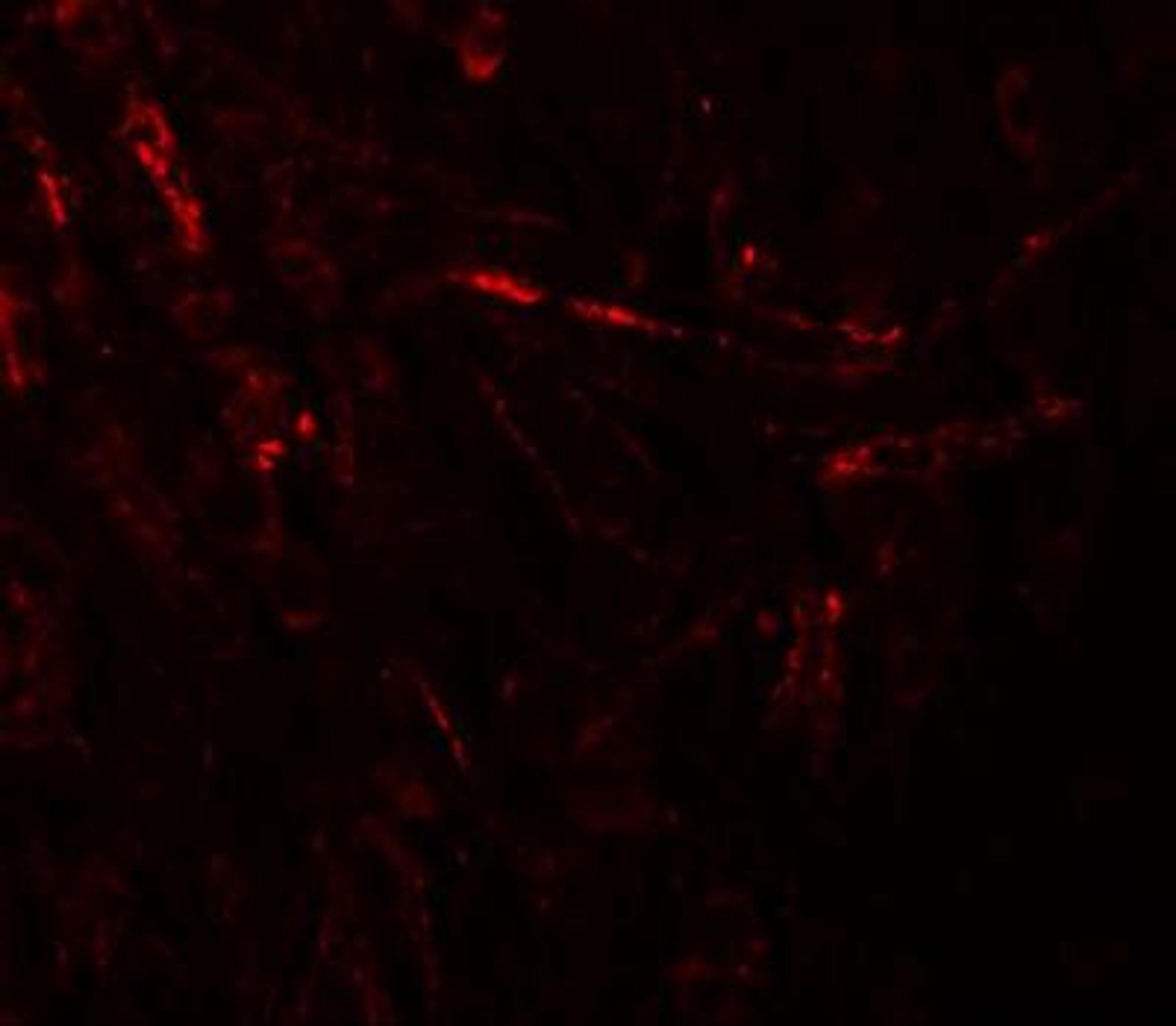 Immunocytochemistry/Immunofluorescence: ZBTB4 Antibody [NBP1-76517] - Immunofluorescence of ZBTB4 in human brain tissue with ZBTB4 antibody at 20 ug/mL.