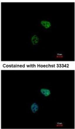 Immunocytochemistry/Immunofluorescence: PSMC6 Antibody [NBP1-32403] - Paraformaldehyde-fixed HeLa, using antibody at 1:500 dilution.