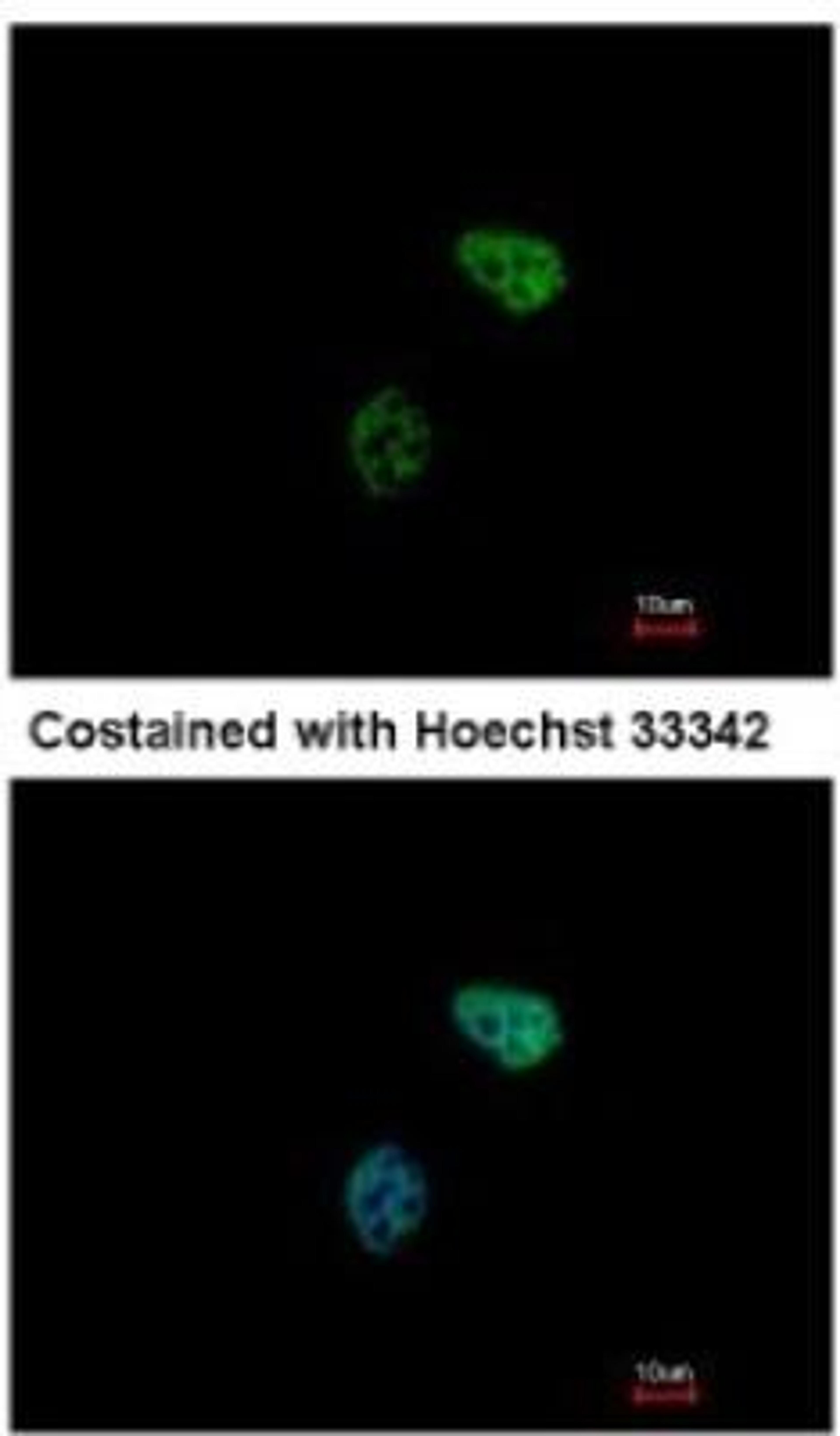 Immunocytochemistry/Immunofluorescence: PSMC6 Antibody [NBP1-32403] - Paraformaldehyde-fixed HeLa, using antibody at 1:500 dilution.