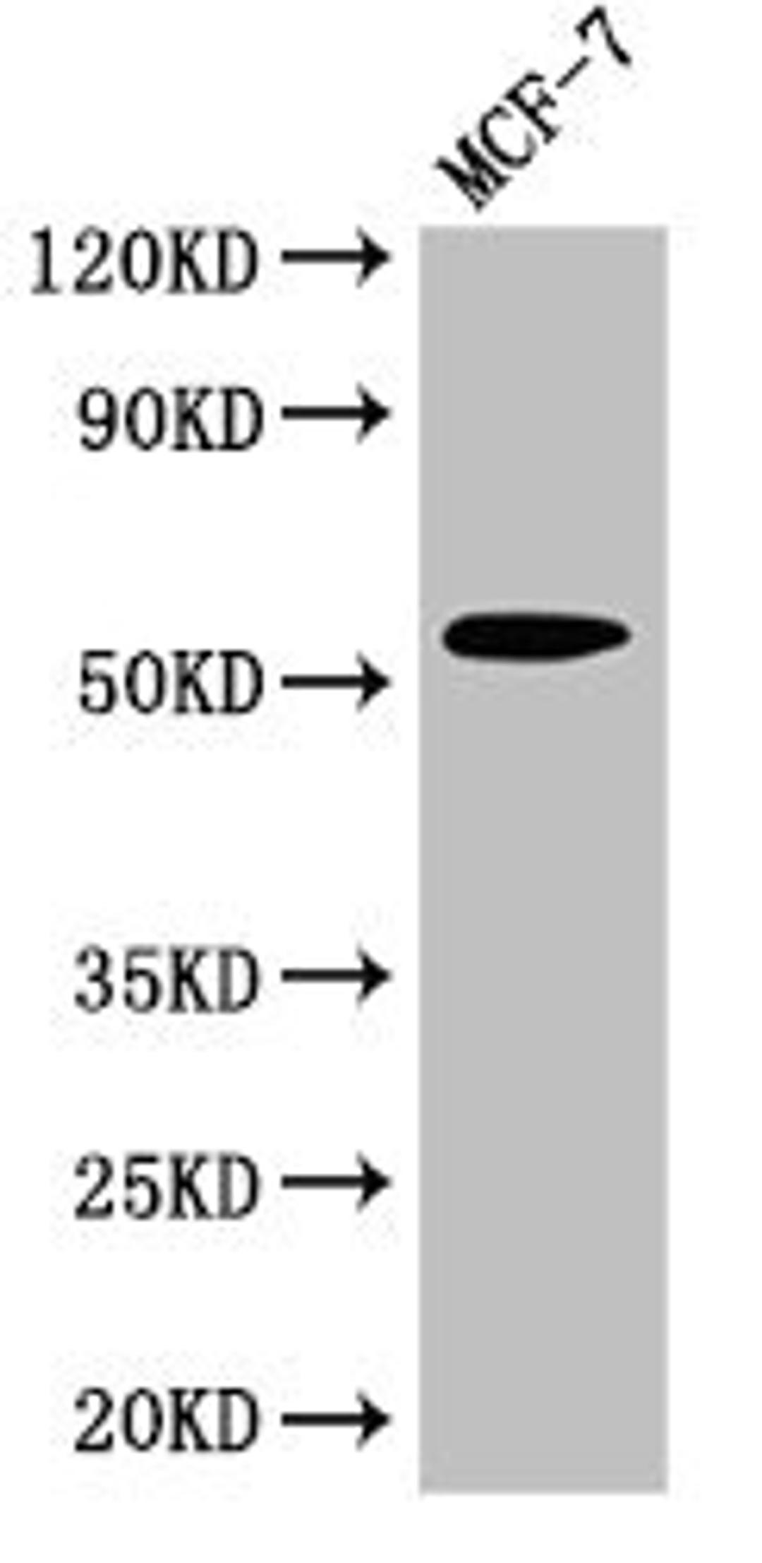 Western Blot. Positive WB detected in: MCF-7 whole cell lysate. All lanes: CYP51A1 antibody at 2.7µg/ml. Secondary. Goat polyclonal to rabbit IgG at 1/50000 dilution. Predicted band size: 57, 47 kDa. Observed band size: 57 kDa