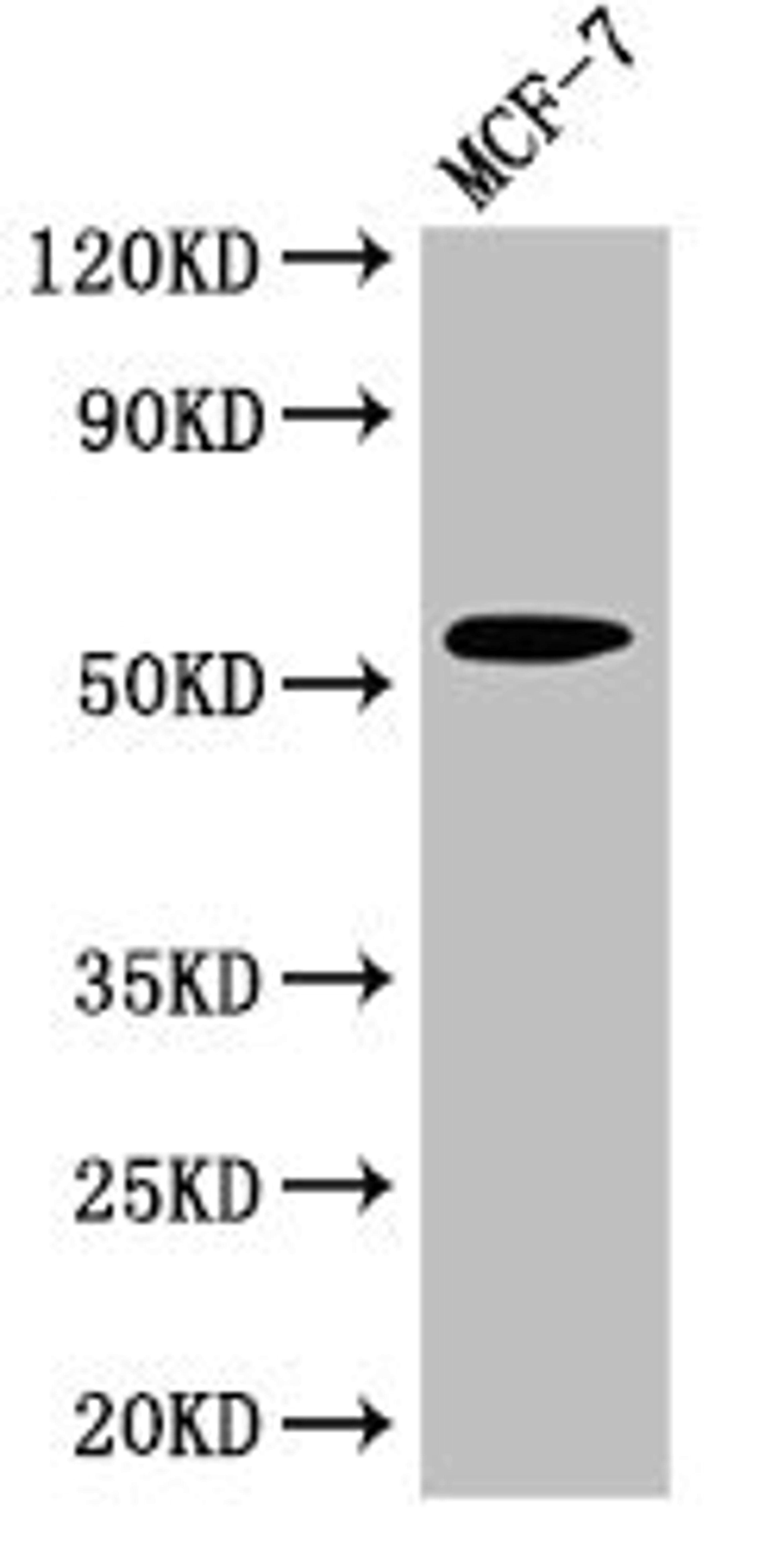 Western Blot. Positive WB detected in: MCF-7 whole cell lysate. All lanes: CYP51A1 antibody at 2.7µg/ml. Secondary. Goat polyclonal to rabbit IgG at 1/50000 dilution. Predicted band size: 57, 47 kDa. Observed band size: 57 kDa