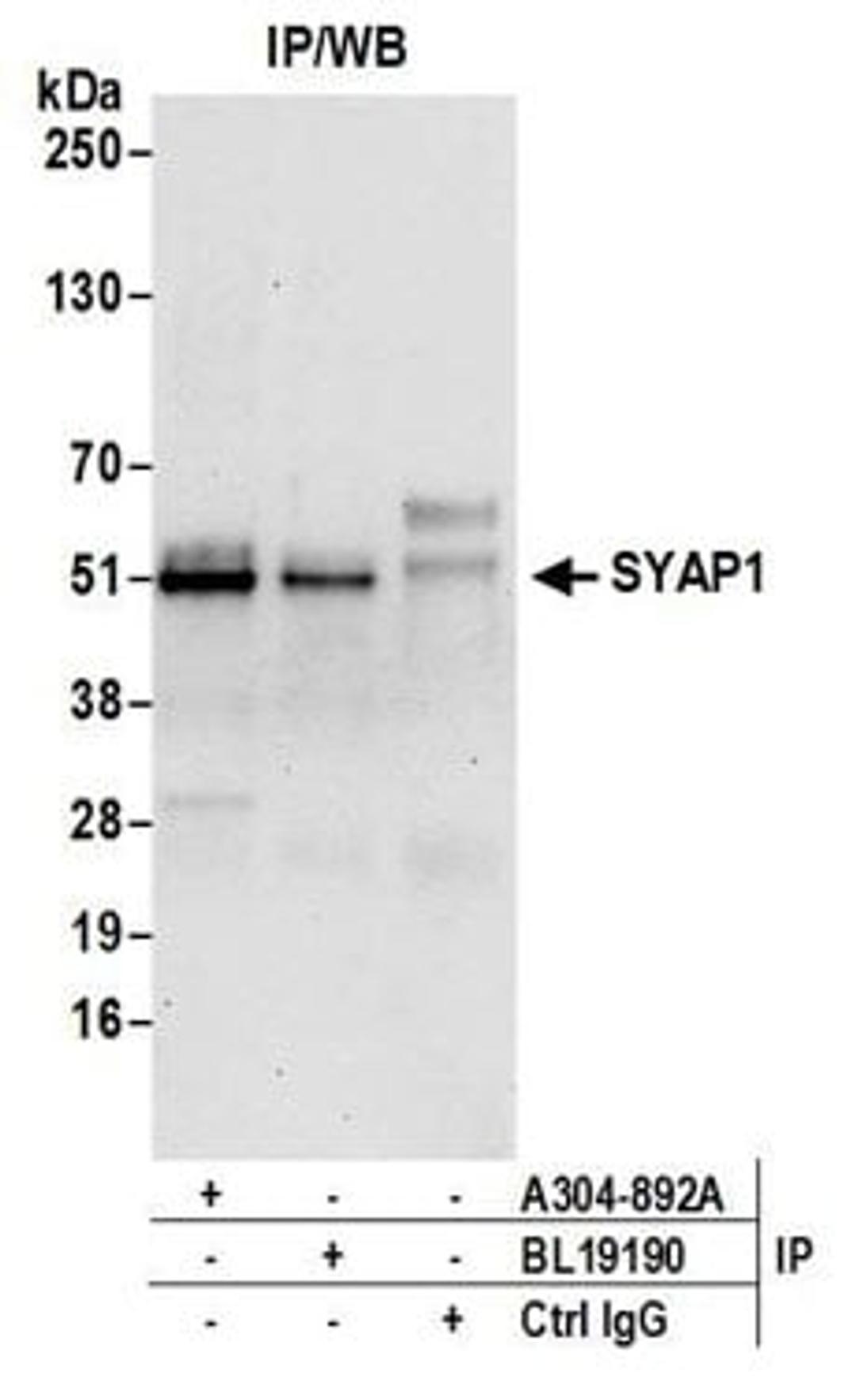 Detection of human SYAP1 by western blot of immunoprecipitates.