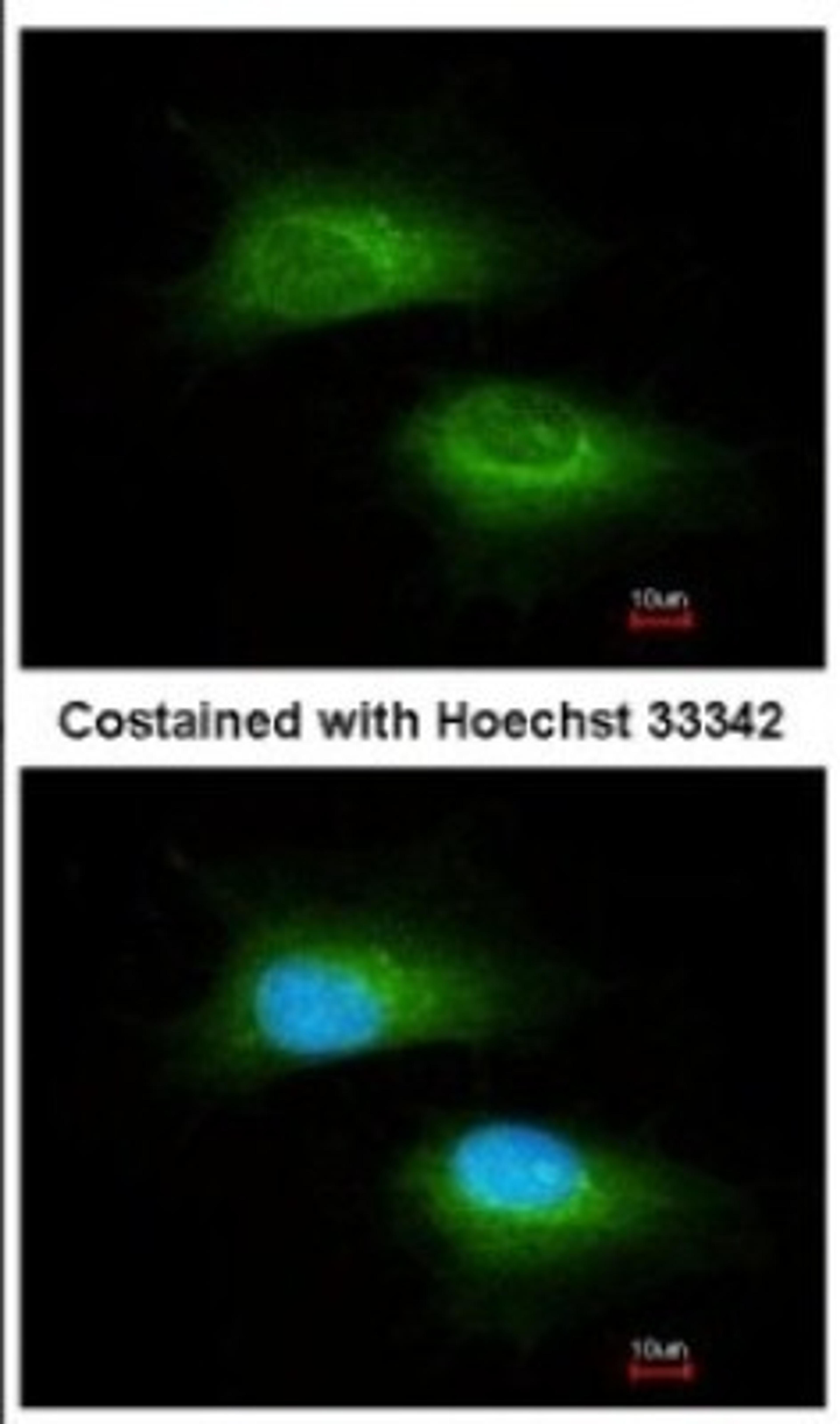 Immunocytochemistry/Immunofluorescence: MRPL12 Antibody [NBP2-19397] - Immunofluorescence analysis of methanol-fixed HeLa, using antibody at 1:200 dilution.