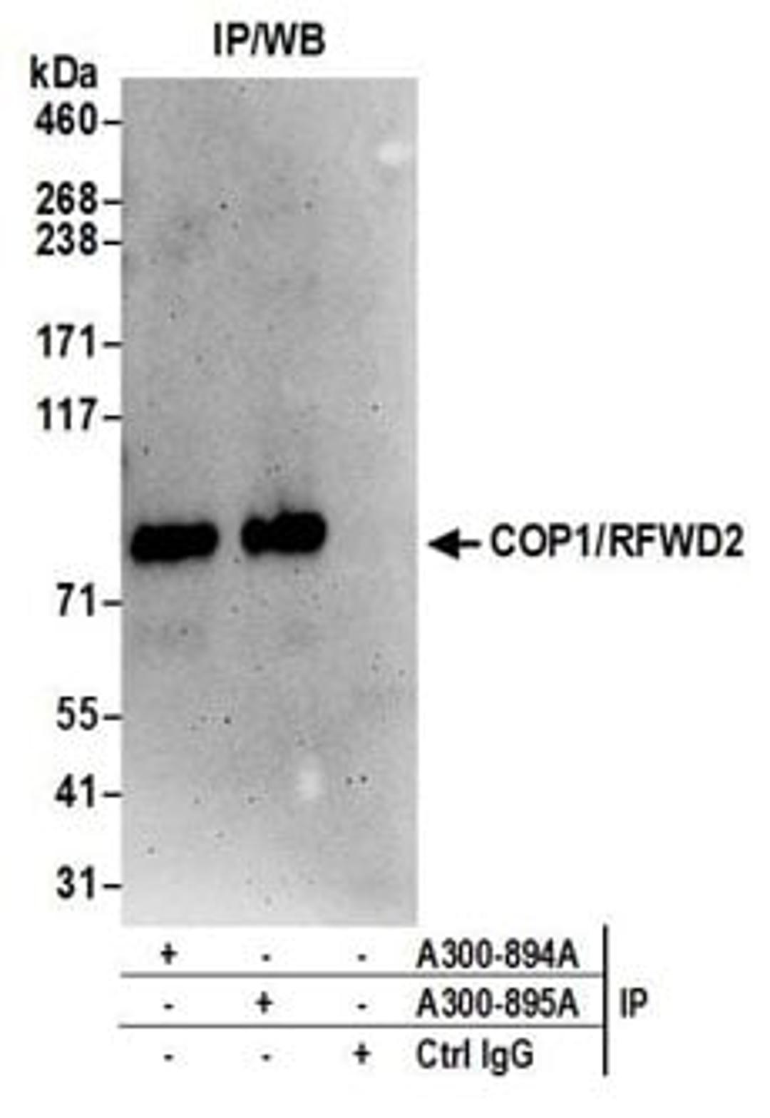 Detection of human COP1/RFWD2 by western blot of immunoprecipitates.