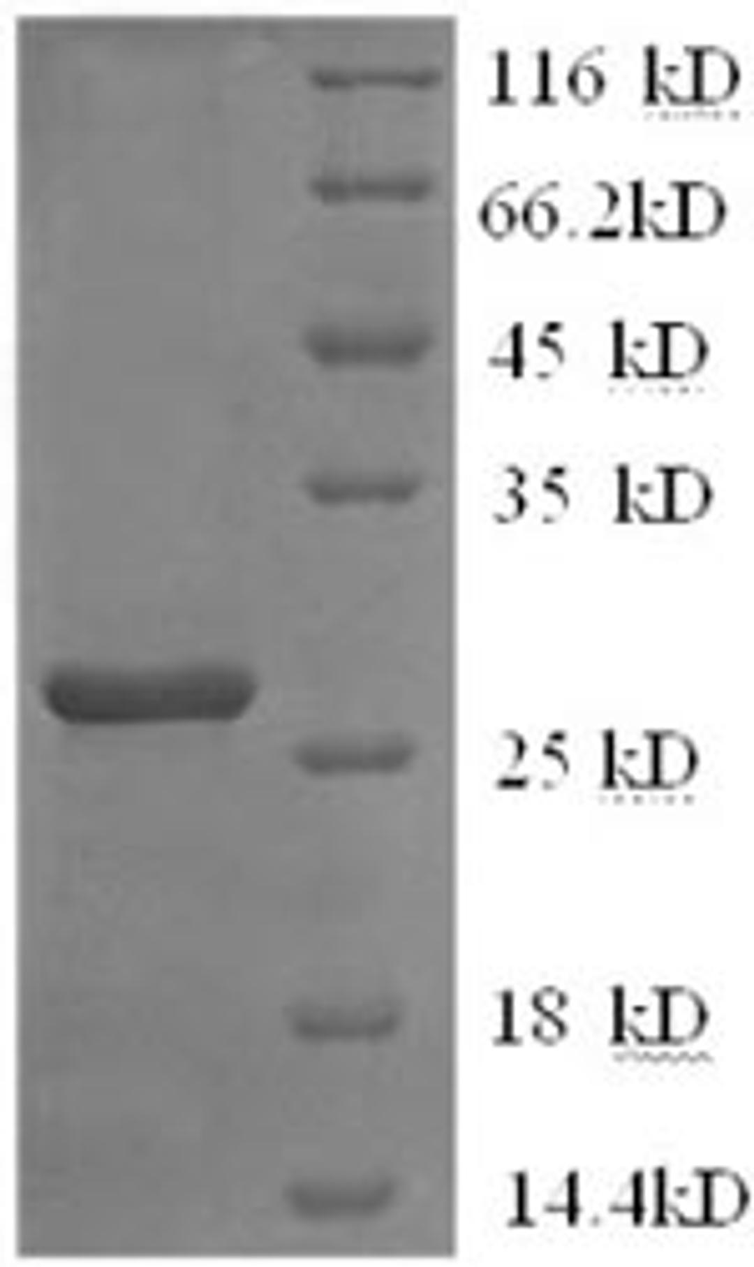 (Tris-Glycine gel) Discontinuous SDS-PAGE (reduced) with 5% enrichment gel and 15% separation gel.