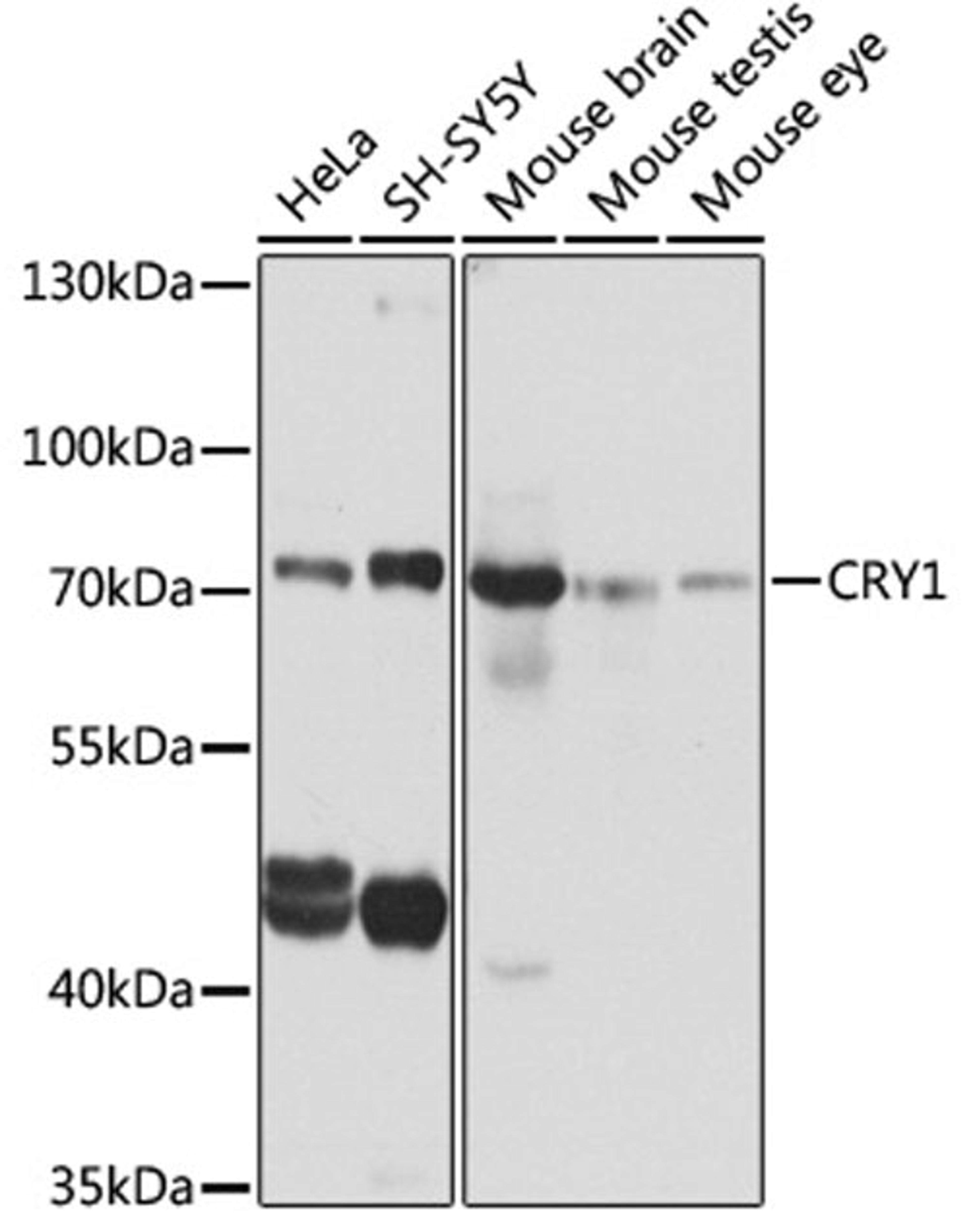 Western blot - CRY1 antibody (A6890)