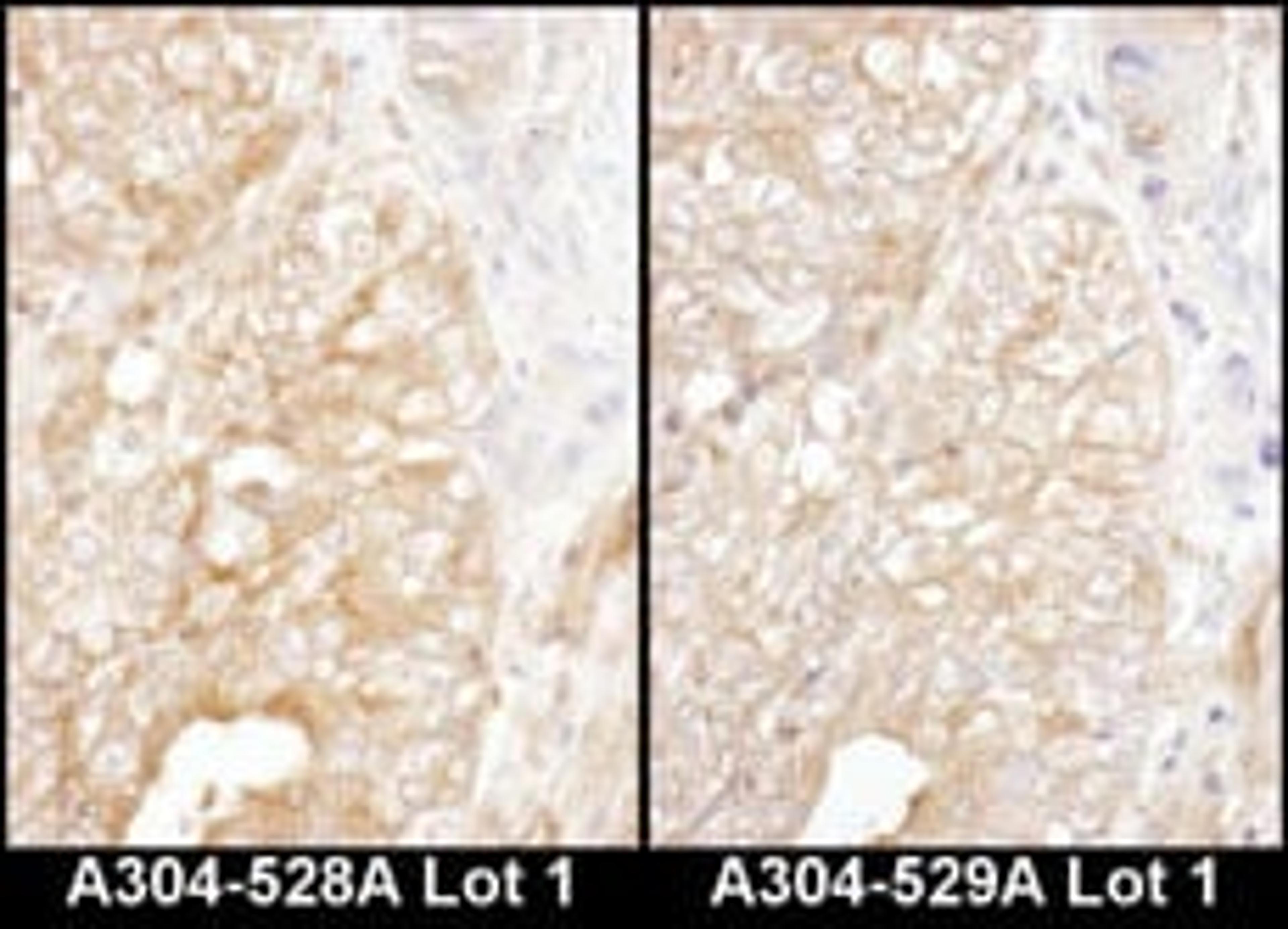 Detection of human DYNC1I2 by immunohistochemistry.