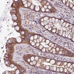 Immunohistochemistry-Paraffin: SLC23A2 Antibody [NBP2-13319] - Staining of human rectum shows distinct cytoplasmic positivity in glandular cells.