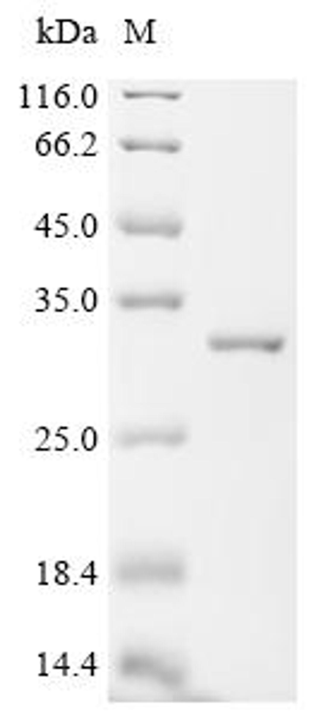 (Tris-Glycine gel) Discontinuous SDS-PAGE (reduced) with 5% enrichment gel and 15% separation gel.