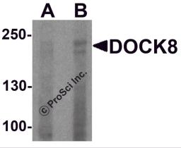 Western blot analysis of DOCK8 in EL4 cell lysate with DOCK8 antibody at (A) 1 and (B) 2 &#956;g/ml.