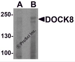 Western blot analysis of DOCK8 in EL4 cell lysate with DOCK8 antibody at (A) 1 and (B) 2 μg/ml.