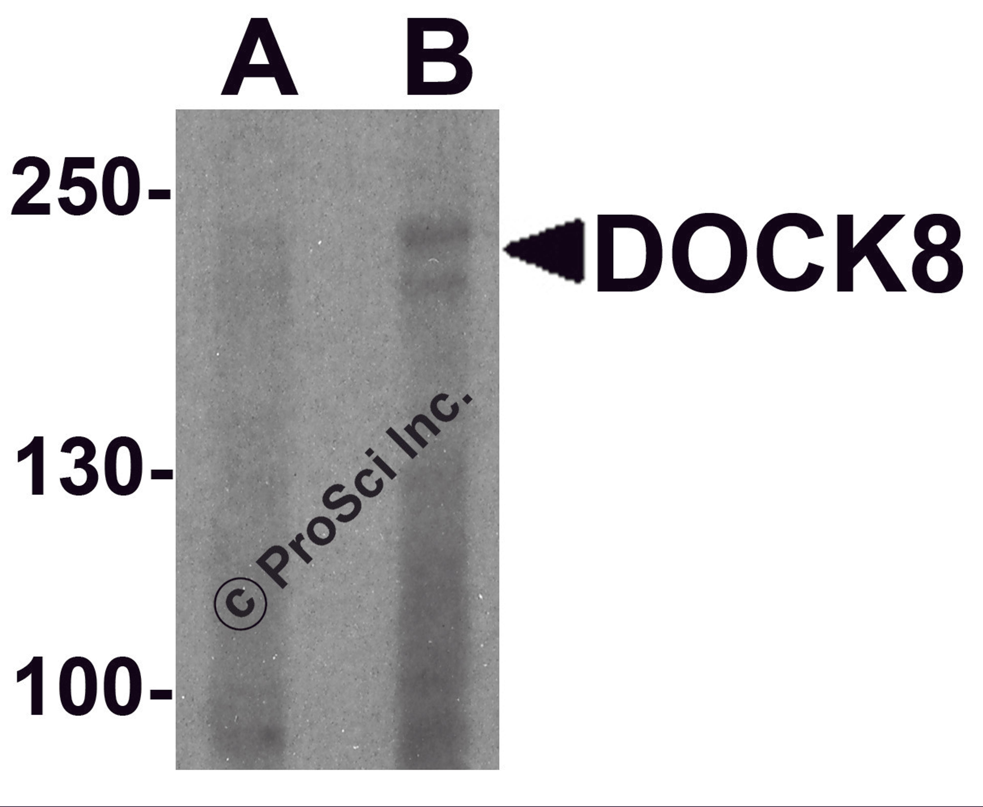 Western blot analysis of DOCK8 in EL4 cell lysate with DOCK8 antibody at (A) 1 and (B) 2 μg/ml.