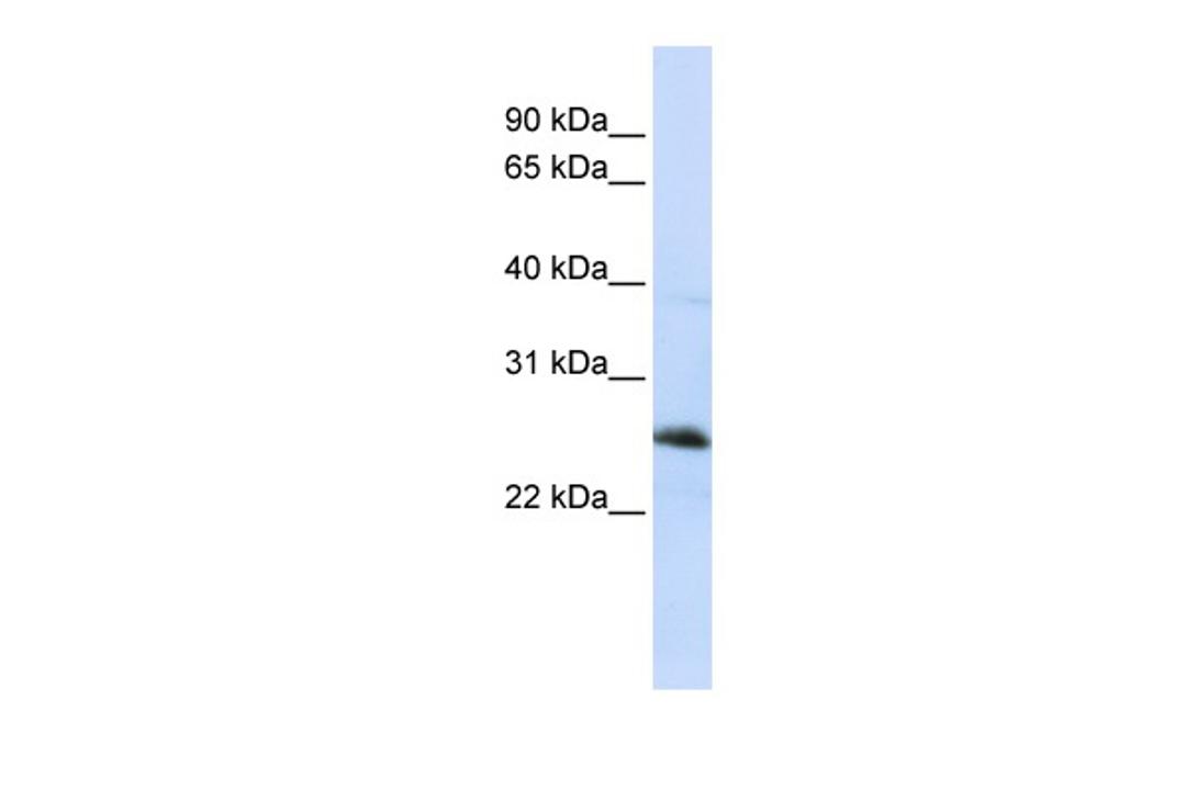 Antibody used in WB on Human Jurkat 0.2-1 ug/ml.