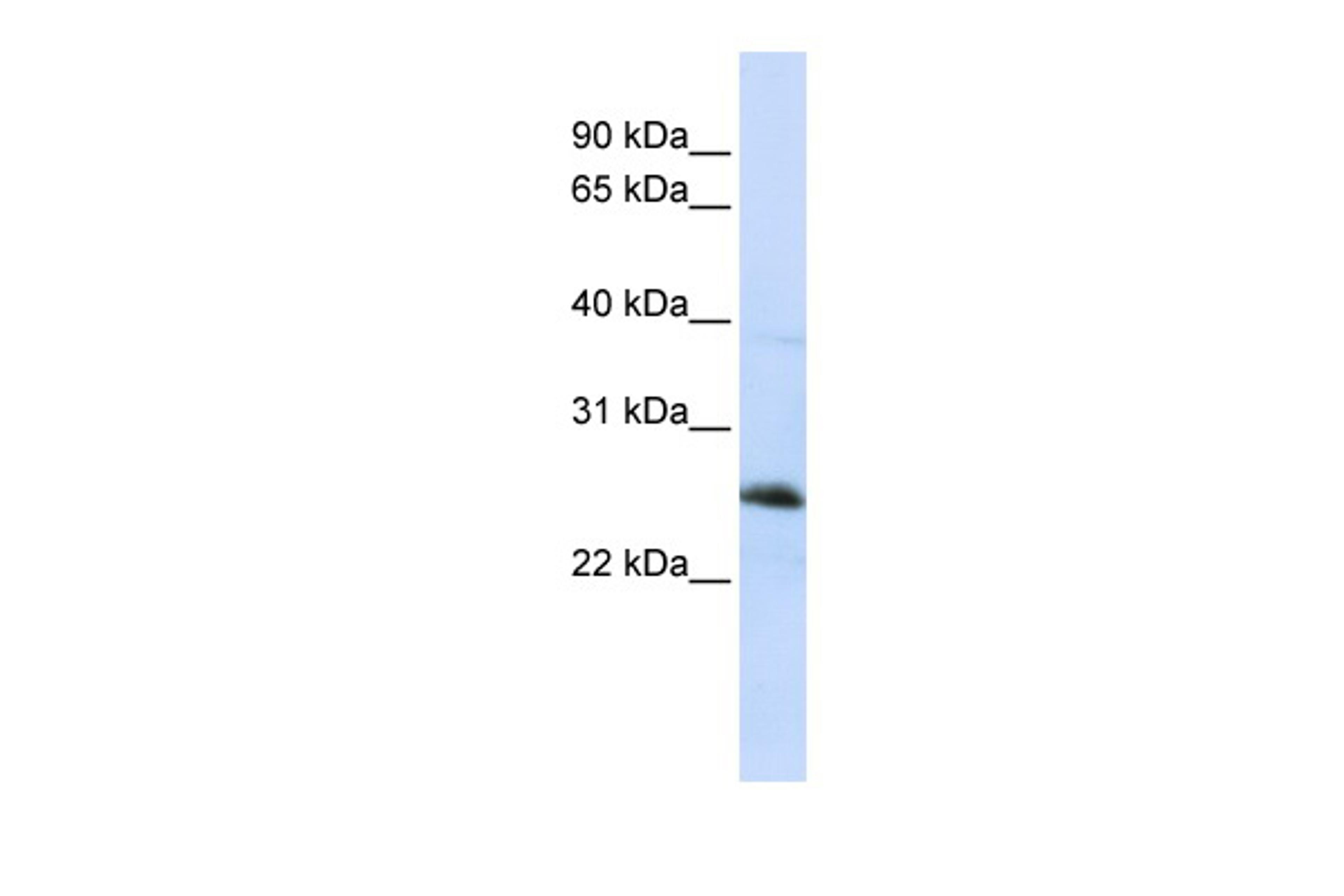 Antibody used in WB on Human Jurkat 0.2-1 ug/ml.