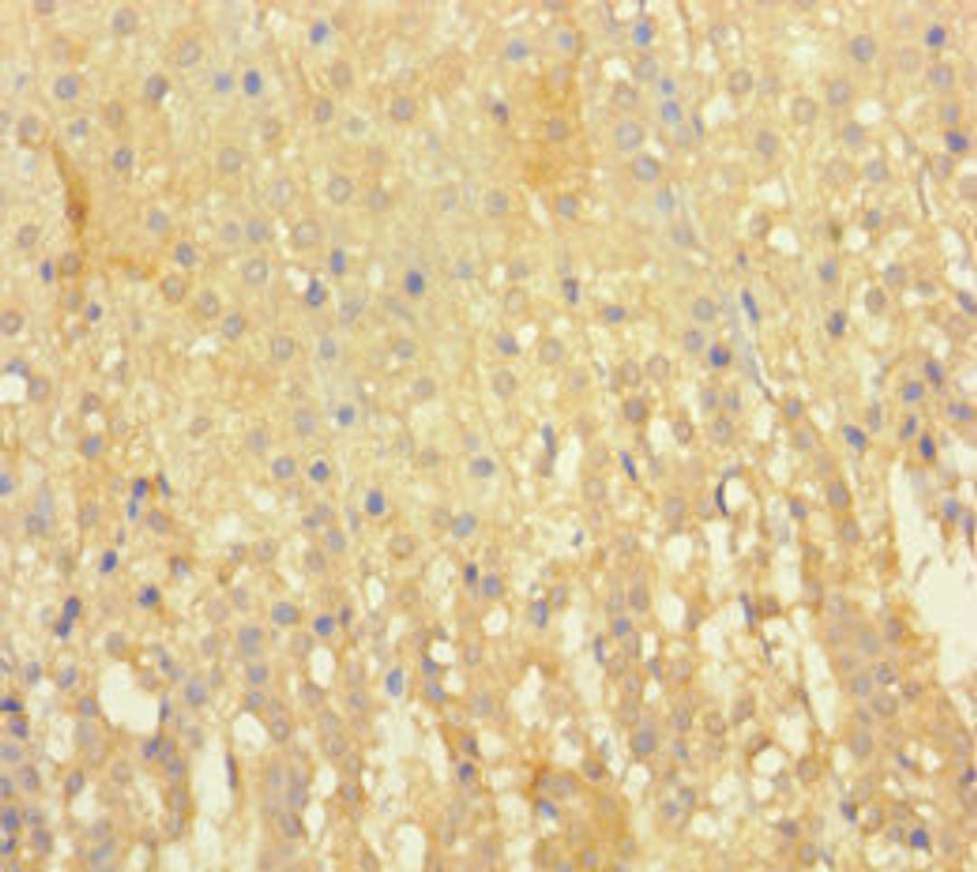 Immunohistochemistry of paraffin-embedded human adrenal gland tissue using CSB-PA007643LA01HU at dilution of 1:100