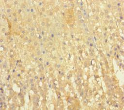 Immunohistochemistry of paraffin-embedded human adrenal gland tissue using CSB-PA007643LA01HU at dilution of 1:100