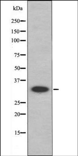 Western blot analysis of HepG2 whole cell lysates using MAX -Phospho-Ser11- antibody