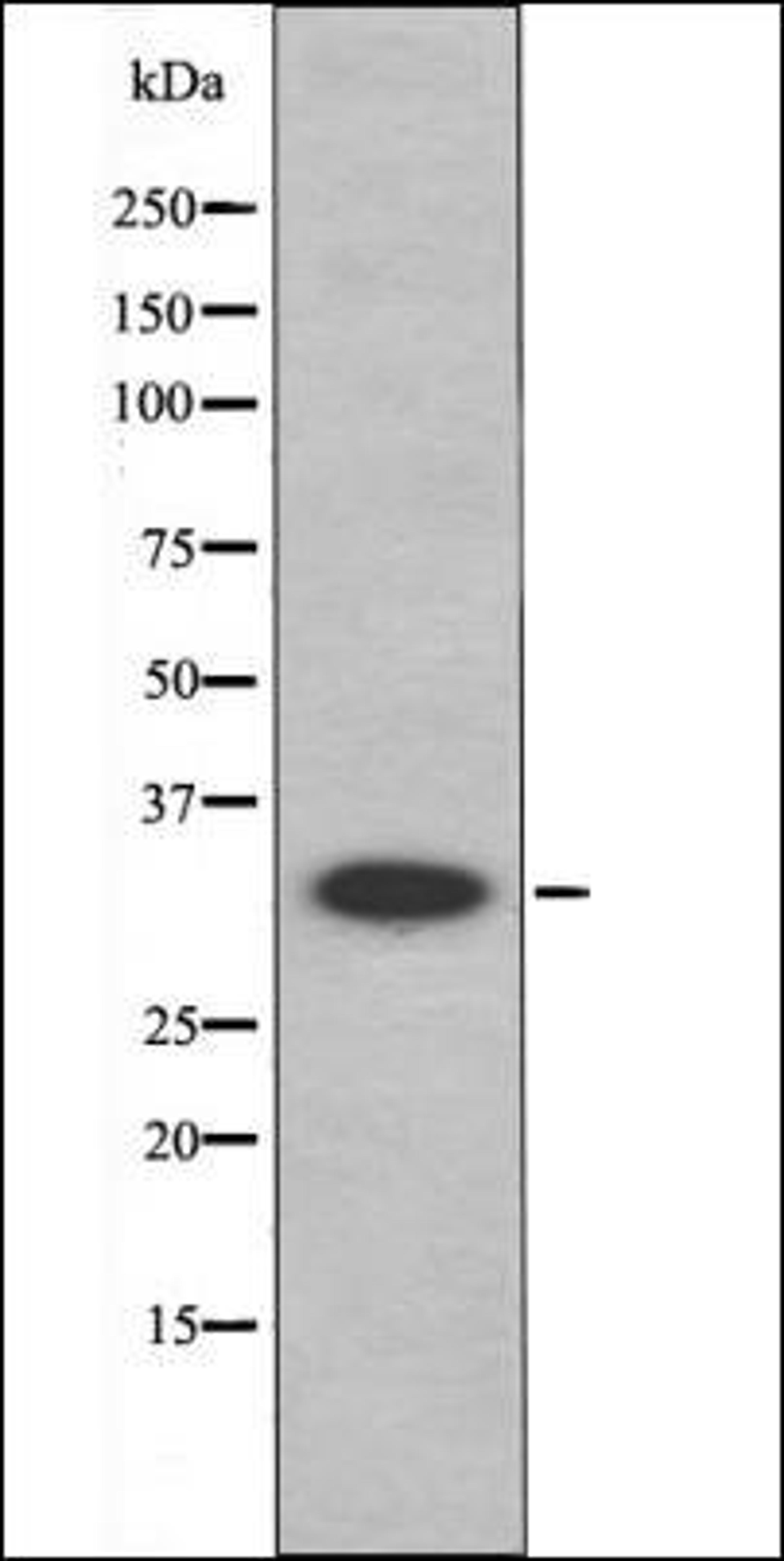 Western blot analysis of HepG2 whole cell lysates using MAX -Phospho-Ser11- antibody