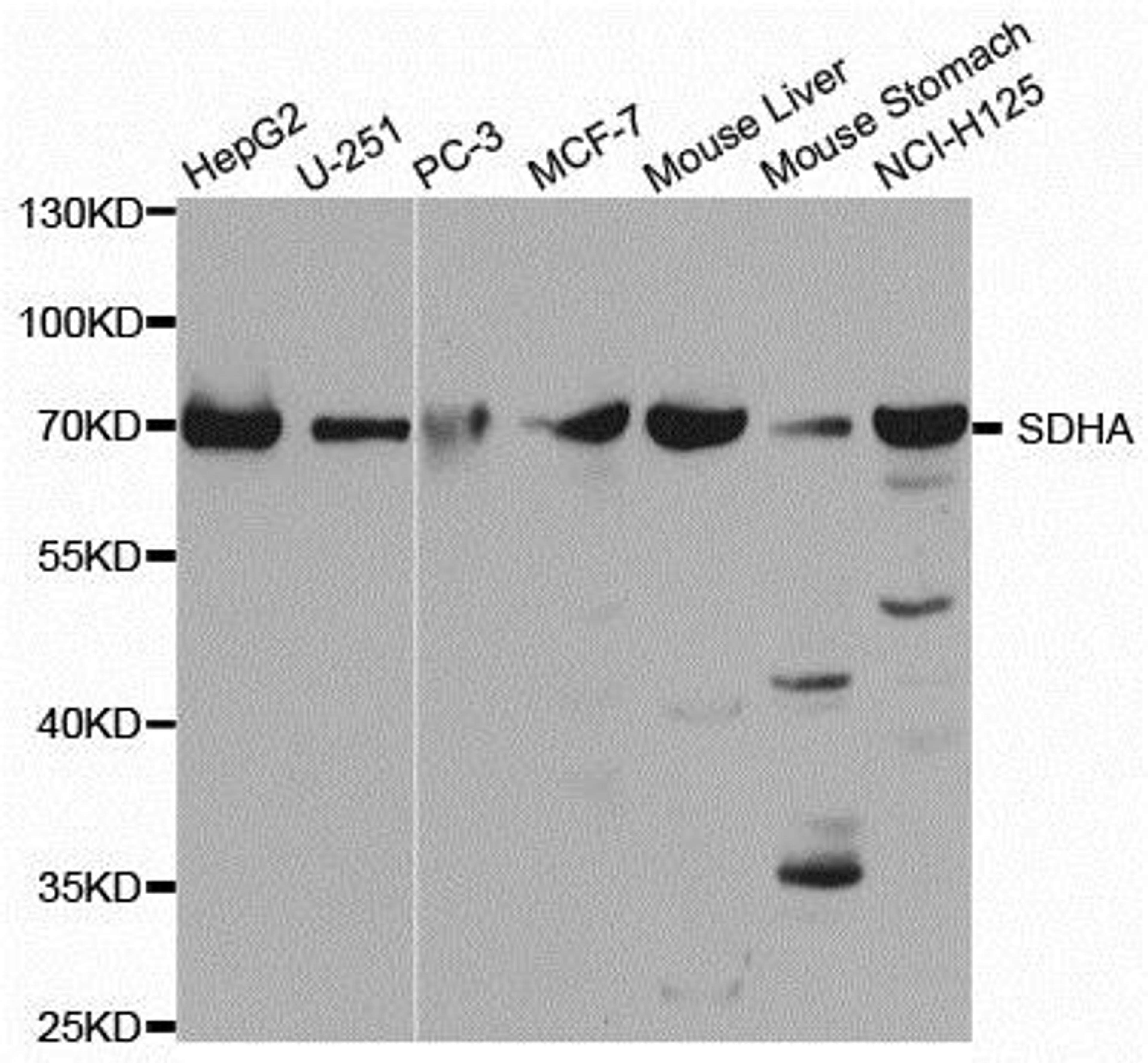 Western blot analysis of extracts of various cell lines using SDHA antibody