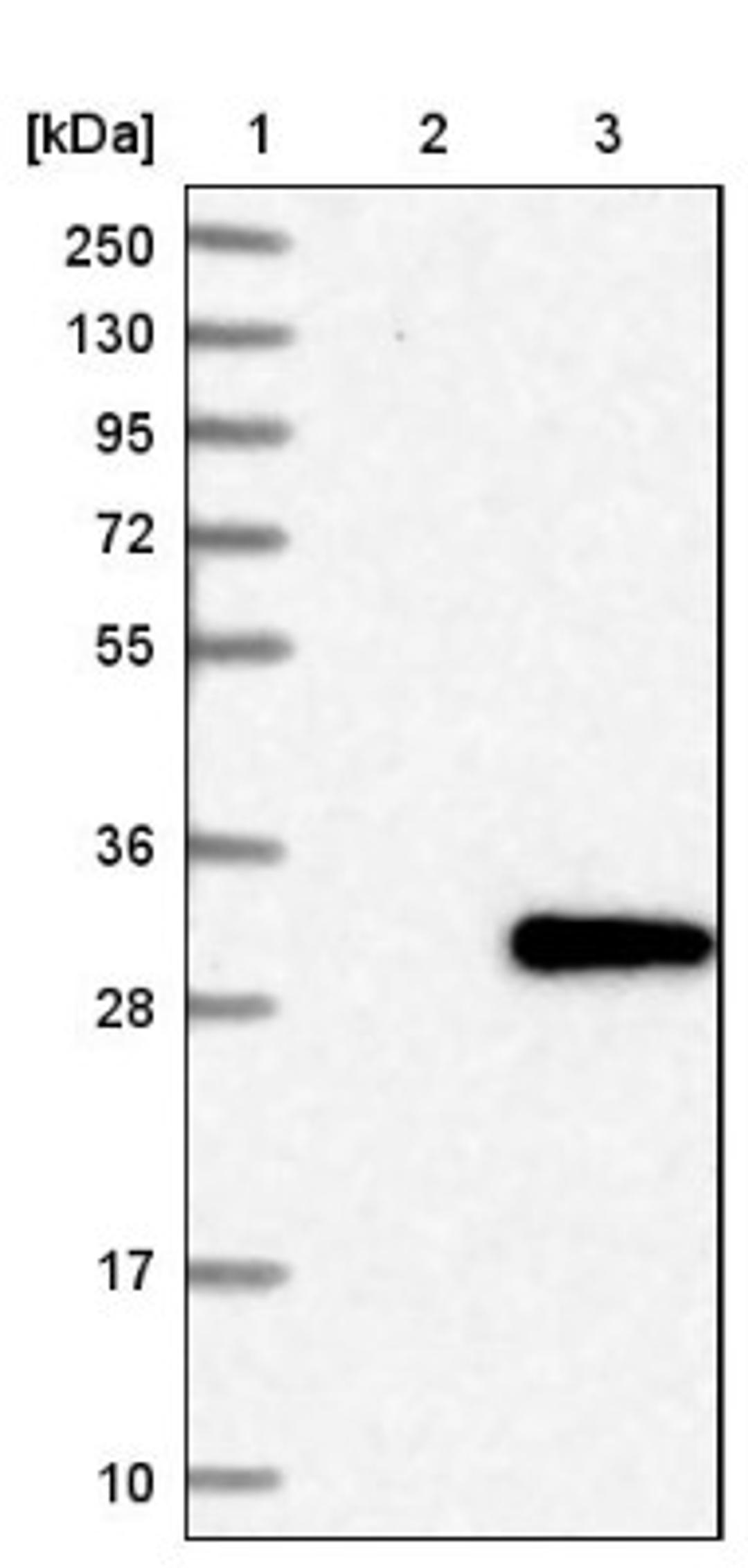 Western Blot: FKBP14 Antibody [NBP1-83890] - Lane 1: Marker [kDa] 250, 130, 95, 72, 55, 36, 28, 17, 10<br/>Lane 2: Negative control (vector only transfected HEK293T lysate)<br/>Lane 3: Over-expression lysate (Co-expressed with a C-terminal myc-DDK tag (~3.1 kDa) in mammalian HEK293T cells, LY413430)