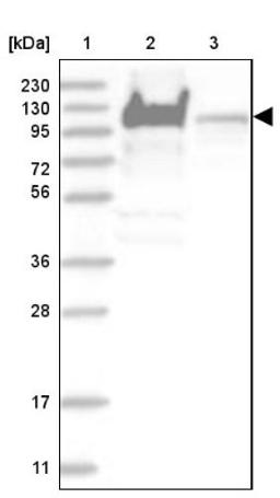 Western Blot: YTHDC1 Antibody [NBP1-81353] - Lane 1: Marker [kDa] 230, 130, 95, 72, 56, 36, 28, 17, 11<br/>Lane 2: Human cell line RT-4<br/>Lane 3: Human cell line U-251MG sp