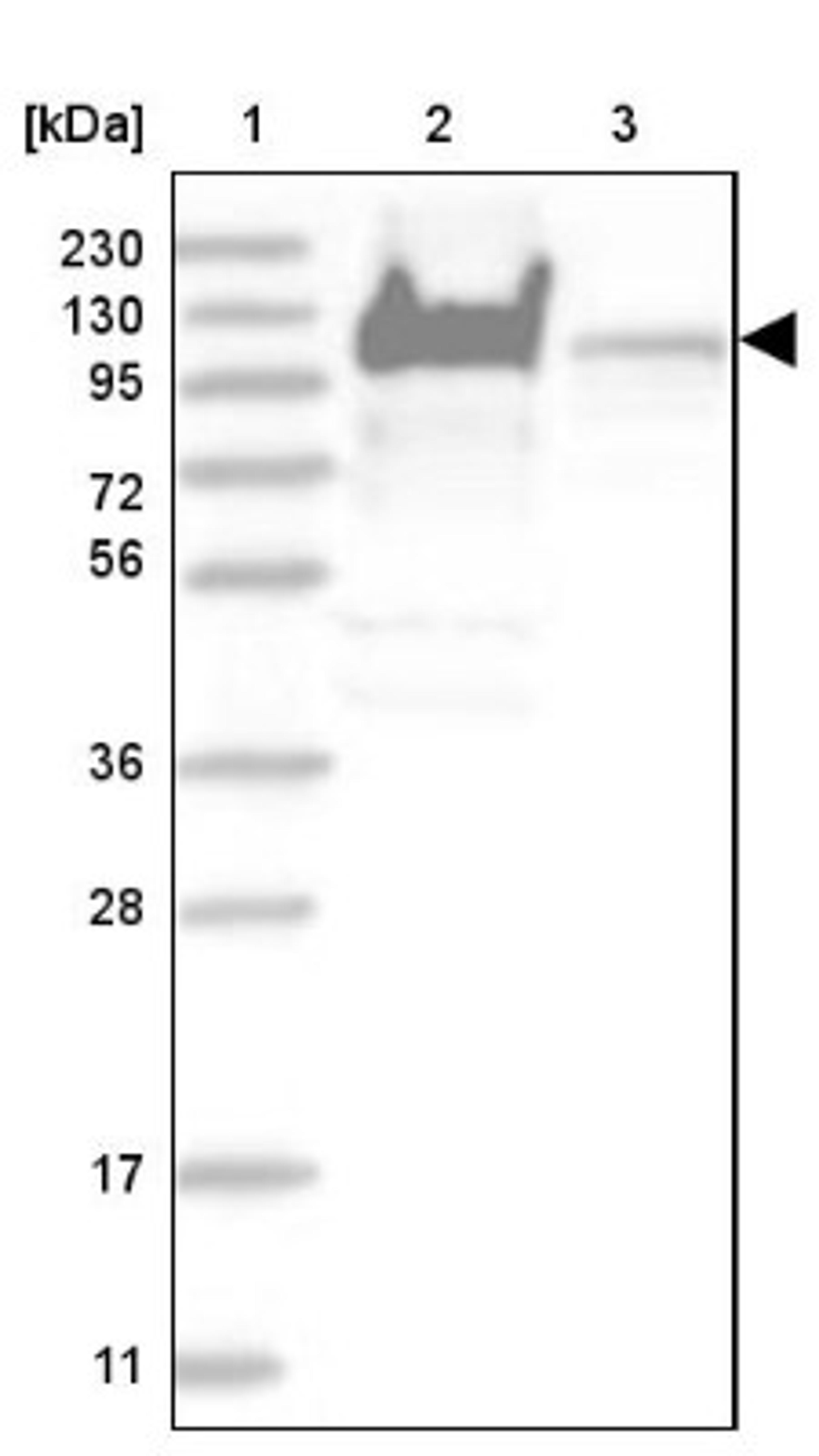 Western Blot: YTHDC1 Antibody [NBP1-81353] - Lane 1: Marker [kDa] 230, 130, 95, 72, 56, 36, 28, 17, 11<br/>Lane 2: Human cell line RT-4<br/>Lane 3: Human cell line U-251MG sp