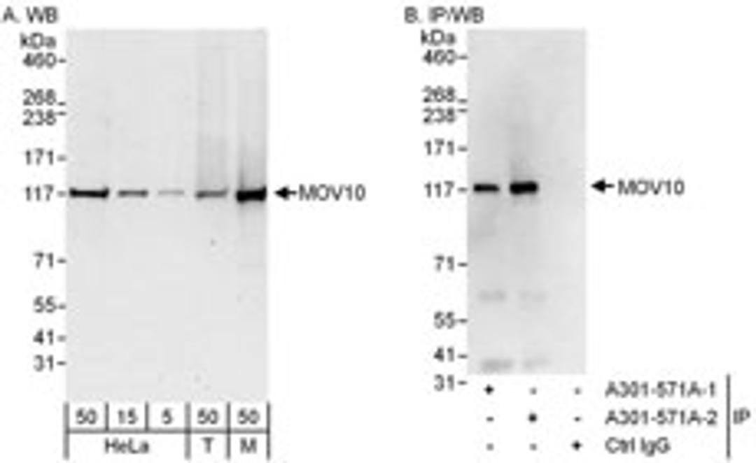 Detection of human and mouse MOV10 by western blot (h&m) and immunoprecipitation (h).