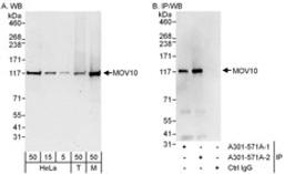 Detection of human and mouse MOV10 by western blot (h&m) and immunoprecipitation (h).