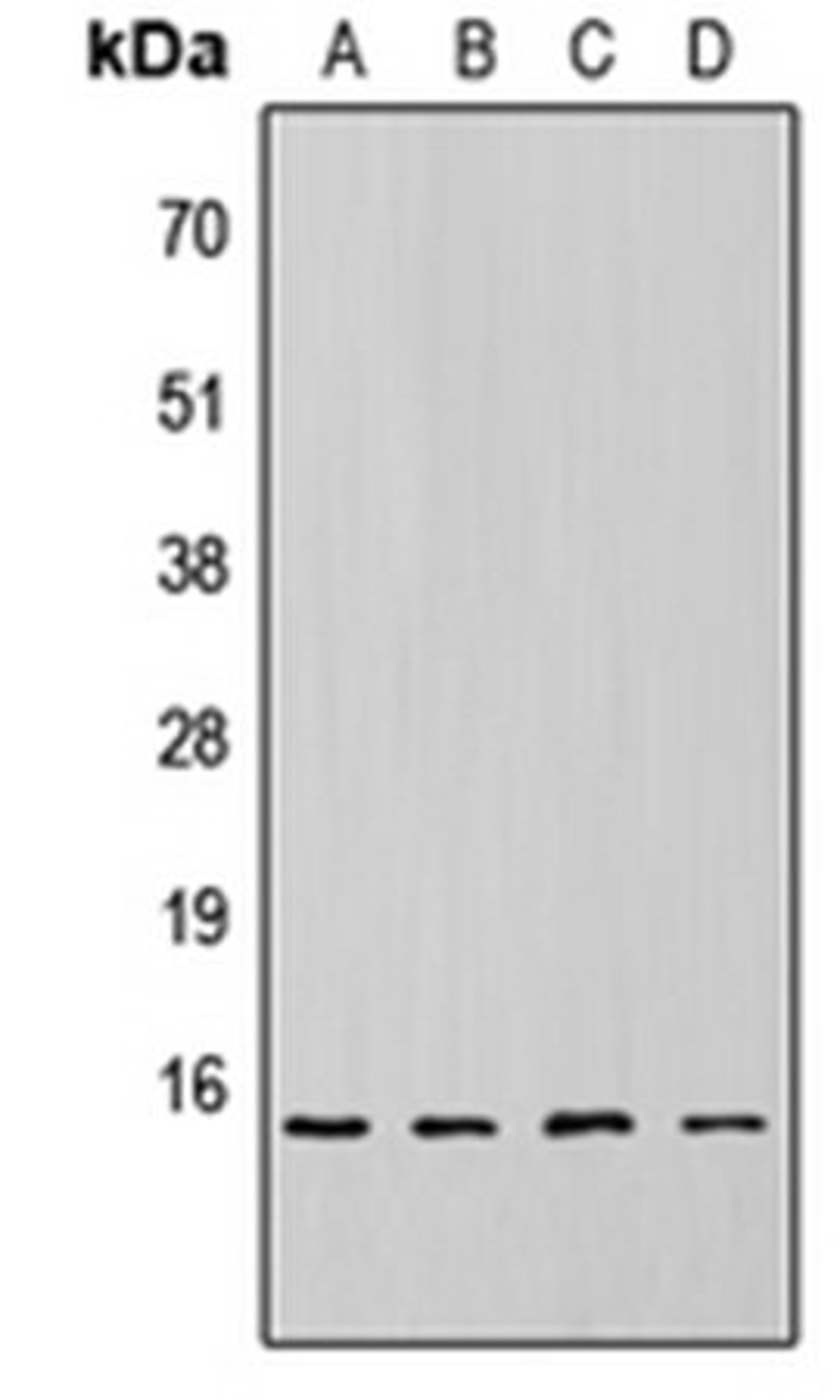 Western blot analysis of HEK293T (Lane 1), NS-1 (Lane 2), H9C2 (Lane 3), rat liver (Lane 4) whole cell lysates using 4EBP1 (phospho-T69) antibody