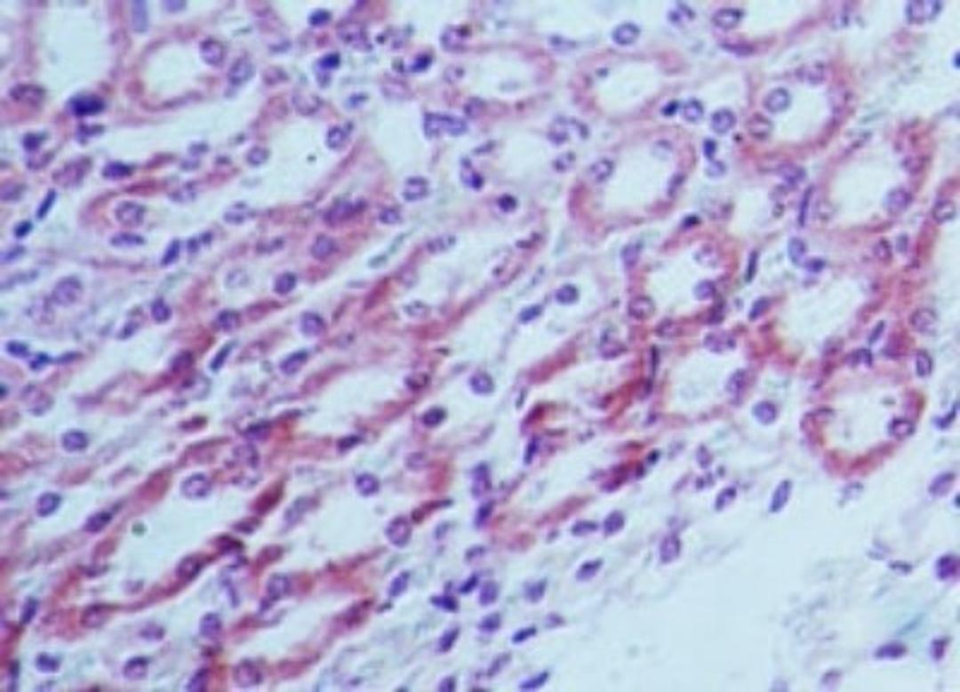 Immunohistochemistry-Paraffin: TLR4 Antibody [NB100-56580] - analysis of TLR4 in mouse kidney tissue using TLR4 antibody at 5 ug/ml.