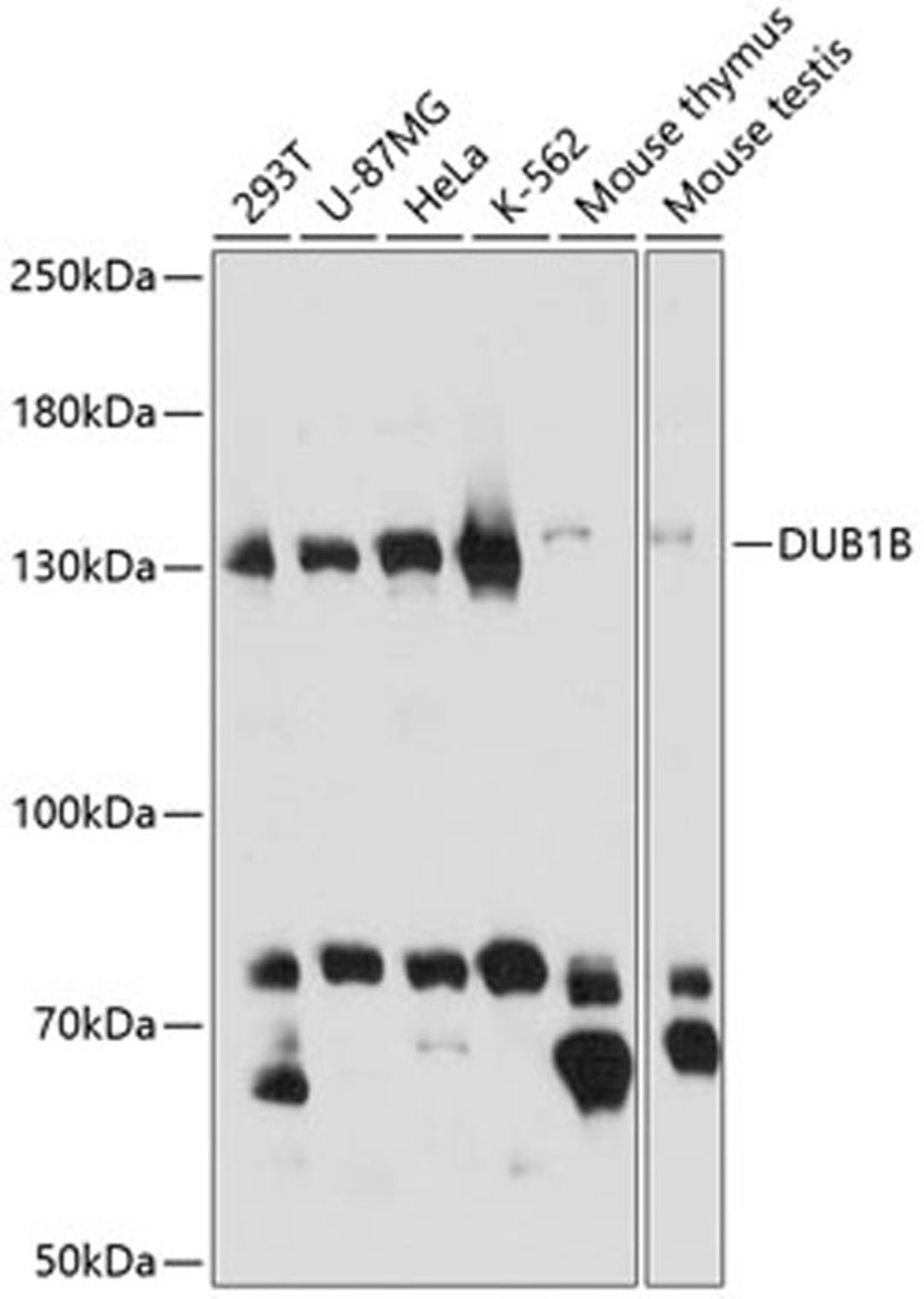 Western blot - BUB1B antibody (A14525)