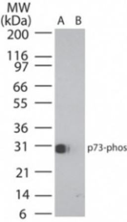 Western Blot: p73 [p Tyr99] Antibody [NB100-56069] - analysis of phosphorylated p73 in (A) recombinant fusion protein containing phosphorylated tyrosine at position 99 and (B) fusion partner without this amino acid, using this antibody. 25 ug/ml.