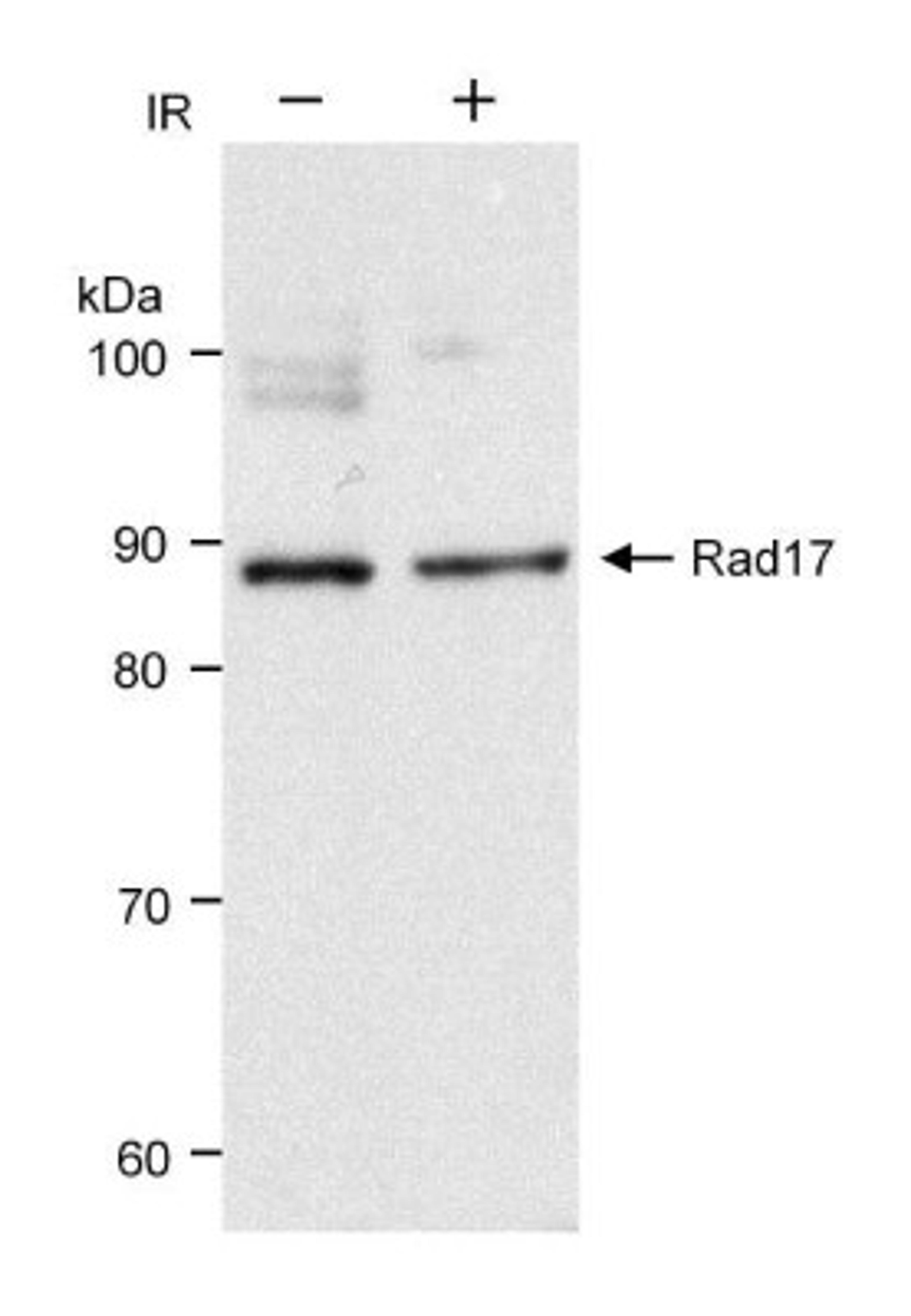 Western Blot: Rad17 Antibody [NB100-272] - Whole cell  lysate (30 ug) from HeLa cells before (-) or after (+) treatment with 10 Gy ionizing radiation.  Antibody used at 0.1 ug/ml.