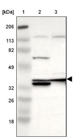 Western Blot: Adenosine Deaminase Antibody [NBP1-87404] - Lane 1: Marker [kDa] 206, 113, 82, 49, 32, 26, 18<br/>Lane 2: Human cell line RT-4<br/>Lane 3: Human cell line U-251MG sp