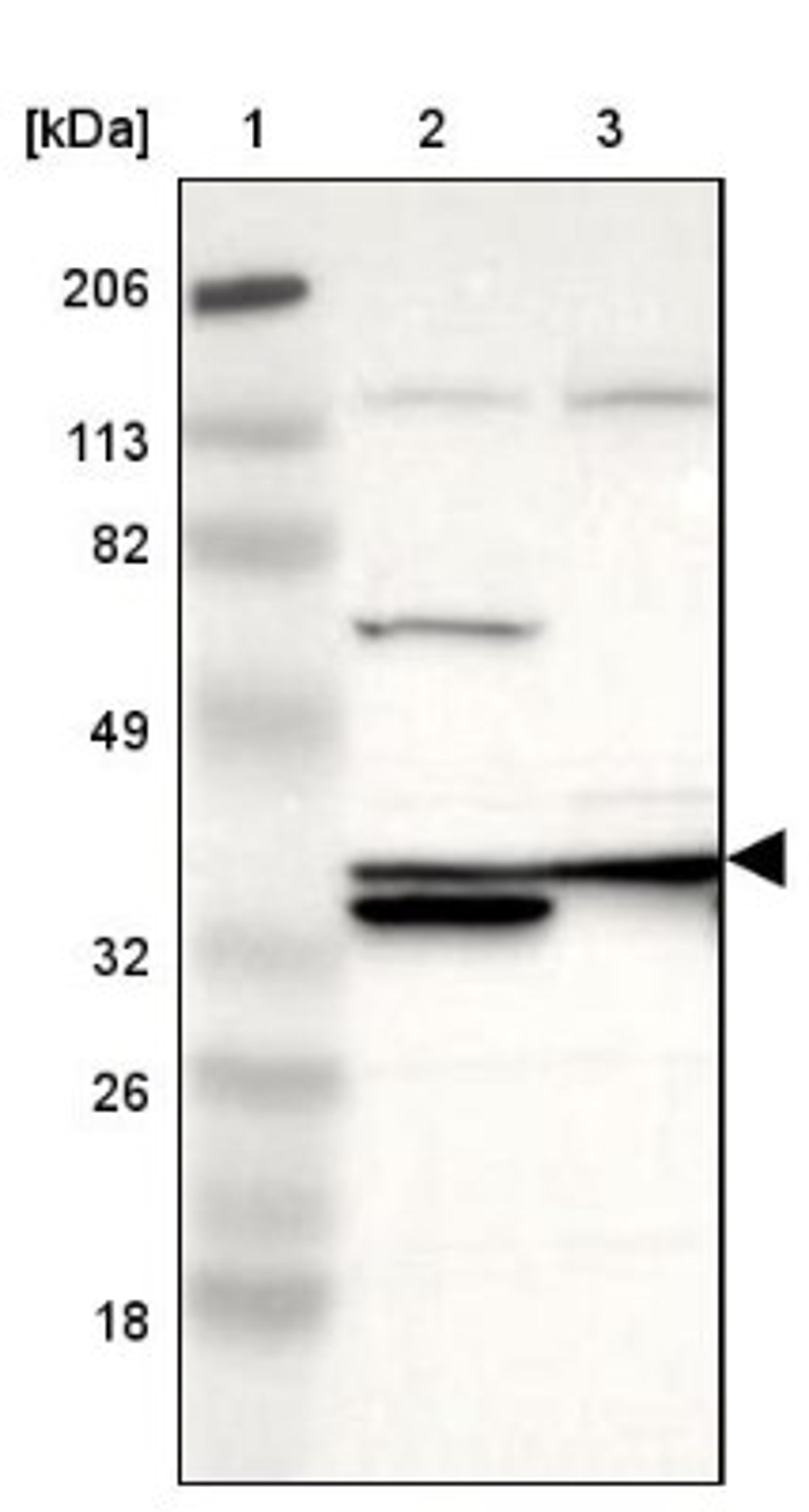 Western Blot: Adenosine Deaminase Antibody [NBP1-87404] - Lane 1: Marker [kDa] 206, 113, 82, 49, 32, 26, 18<br/>Lane 2: Human cell line RT-4<br/>Lane 3: Human cell line U-251MG sp