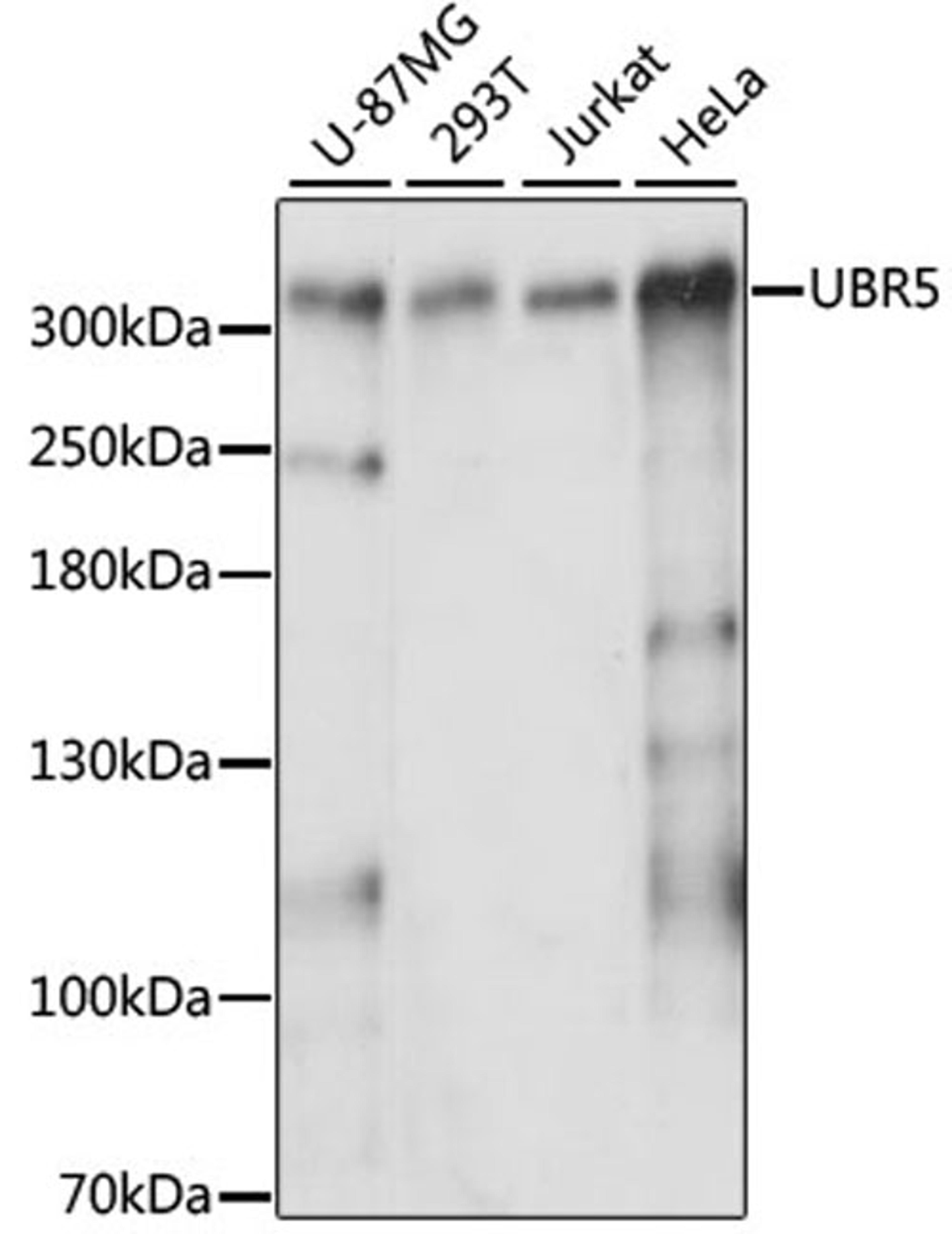 Western blot - UBR5 antibody (A13816)