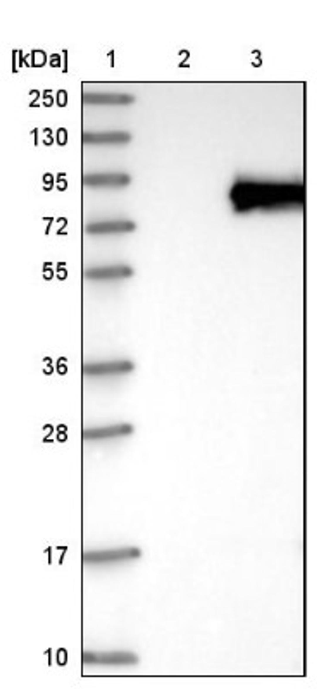 Western Blot: LZTS1 Antibody [NBP1-83907] - Lane 1: Marker [kDa] 250, 130, 95, 72, 55, 36, 28, 17, 10<br/>Lane 2: Negative control (vector only transfected HEK293T lysate)<br/>Lane 3: Over-expression lysate (Co-expressed with a C-terminal myc-DDK tag (~3.1 kDa) in mammalian HEK293T cells, LY412145)