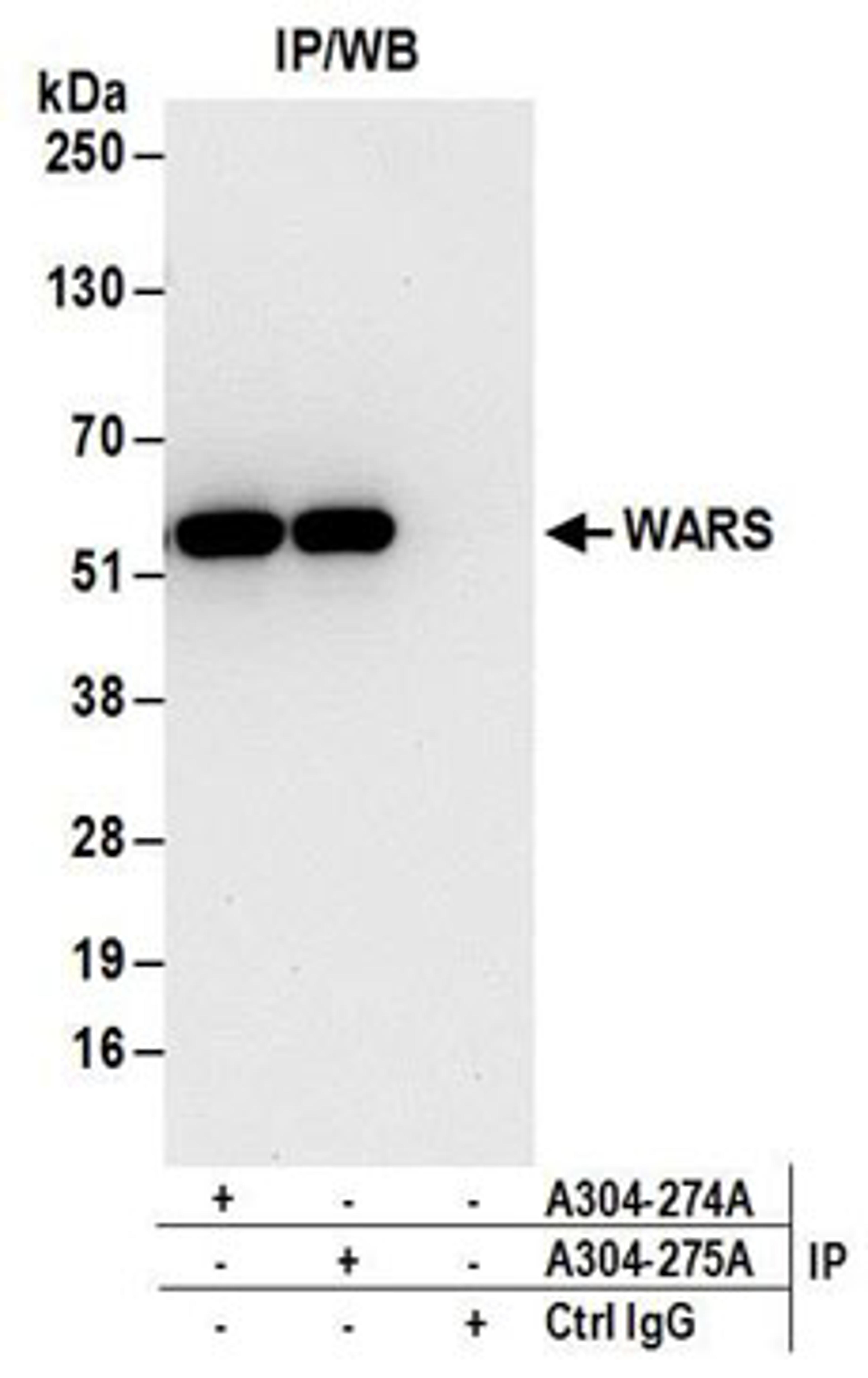 Detection of human WARS by western blot of immunoprecipitates.