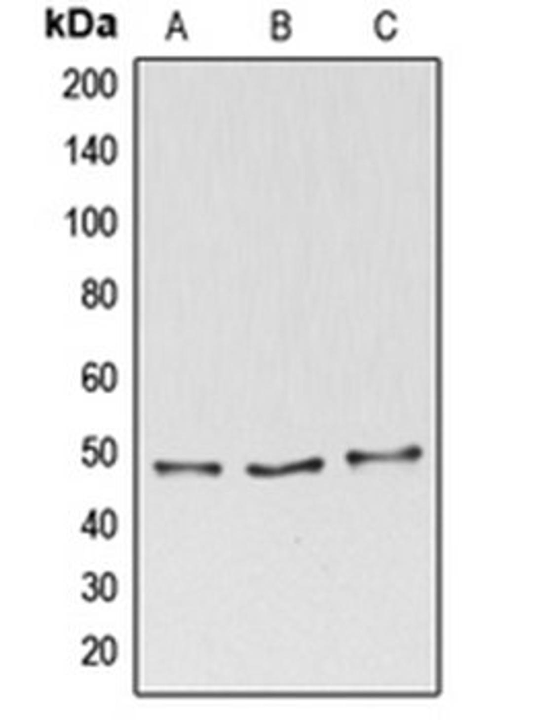 Western blot analysis of HeLa (Lane 1), MOLT4 (Lane 2), THP1 (Lane 3) whole cell lysates using BAG4 antibody