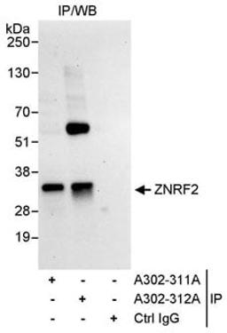 Detection of human ZNRF2 by western blot of immunoprecipitates.