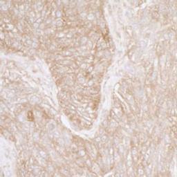 Detection of human Ribosomal Protein S3A by immunohistochemistry.