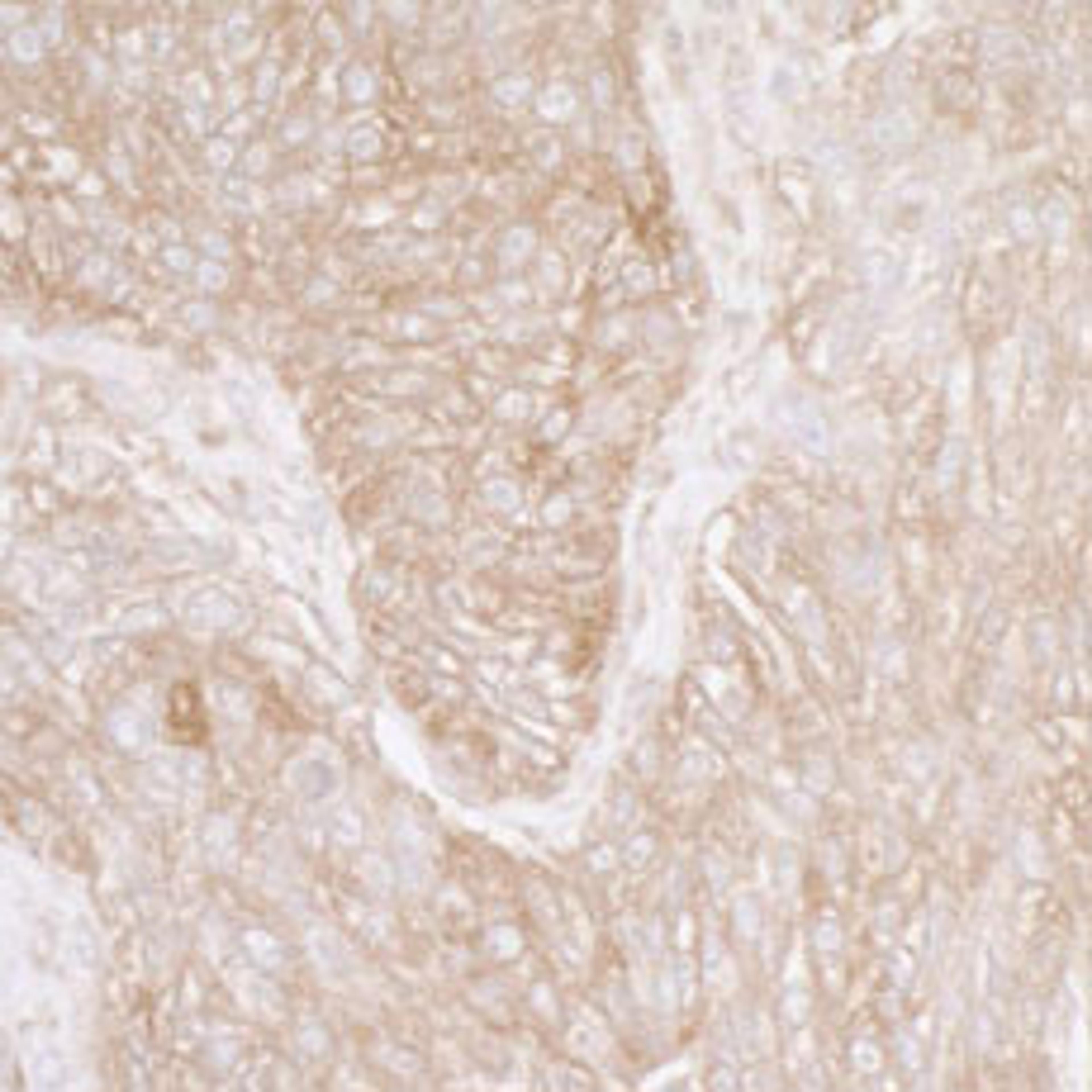 Detection of human Ribosomal Protein S3A by immunohistochemistry.