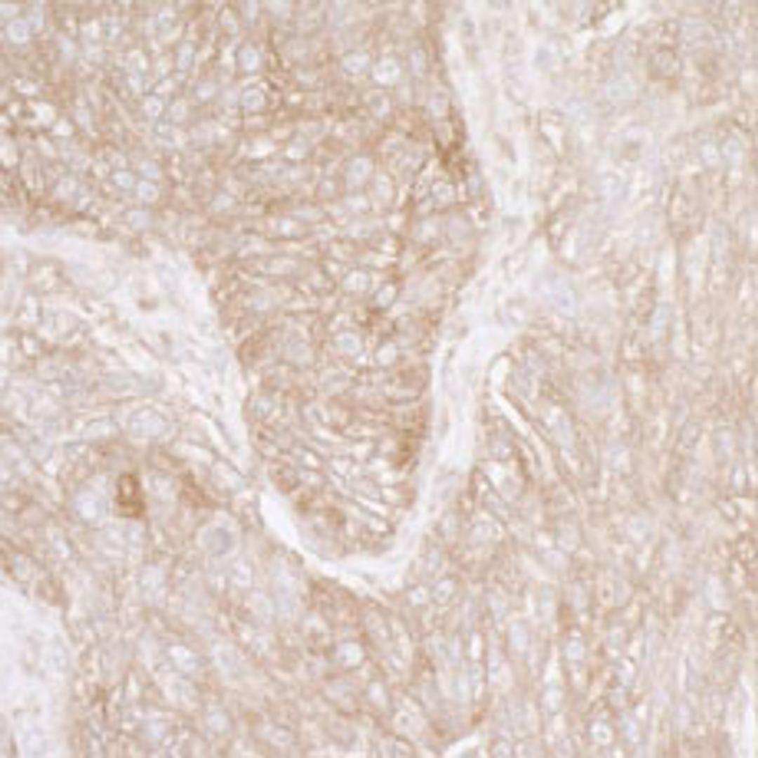 Detection of human Ribosomal Protein S3A by immunohistochemistry.