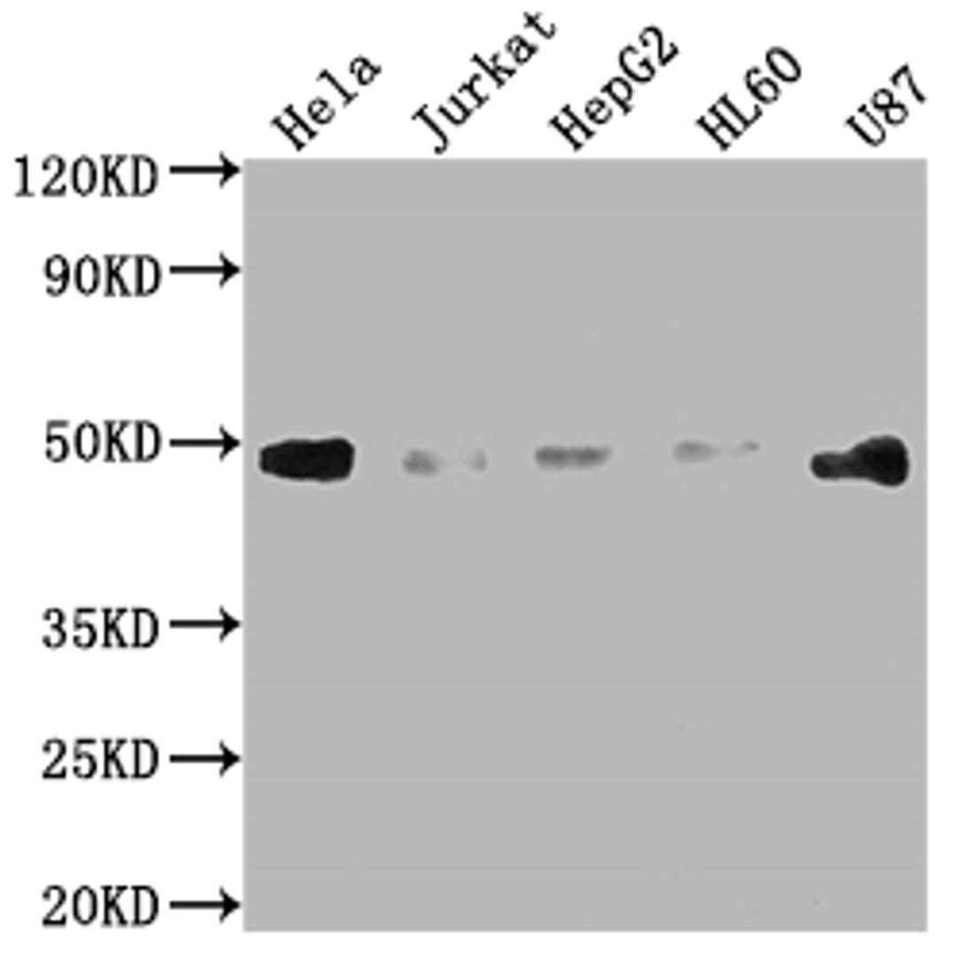 Western Blot. Positive WB detected in: Hela whole cell lysate, Jurkat whole cell lysate, HepG2 whole cell lysate, HL60 whole cell lysate, U87 whole cell lysate. All lanes: FAS antibody at 1:2000. Secondary. Goat polyclonal to rabbit IgG at 1/50000 dilution. Predicted band size: 38, 12, 10, 17, 15, 36, 25 kDa. Observed band size: 45 kDa. 