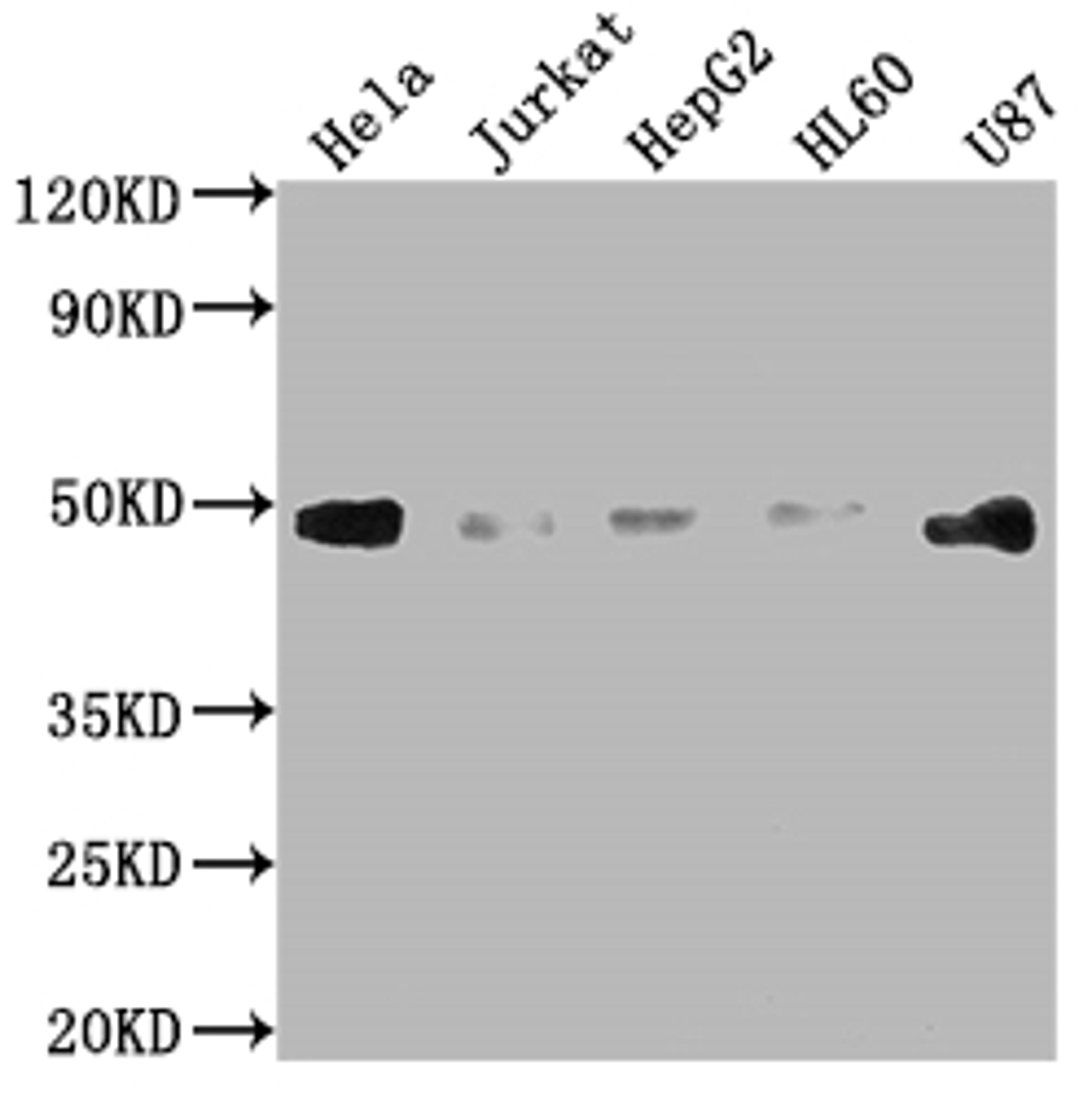 Western Blot. Positive WB detected in: Hela whole cell lysate, Jurkat whole cell lysate, HepG2 whole cell lysate, HL60 whole cell lysate, U87 whole cell lysate. All lanes: FAS antibody at 1:2000. Secondary. Goat polyclonal to rabbit IgG at 1/50000 dilution. Predicted band size: 38, 12, 10, 17, 15, 36, 25 kDa. Observed band size: 45 kDa. 