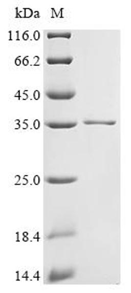 (Tris-Glycine gel) Discontinuous SDS-PAGE (reduced) with 5% enrichment gel and 15% separation gel.