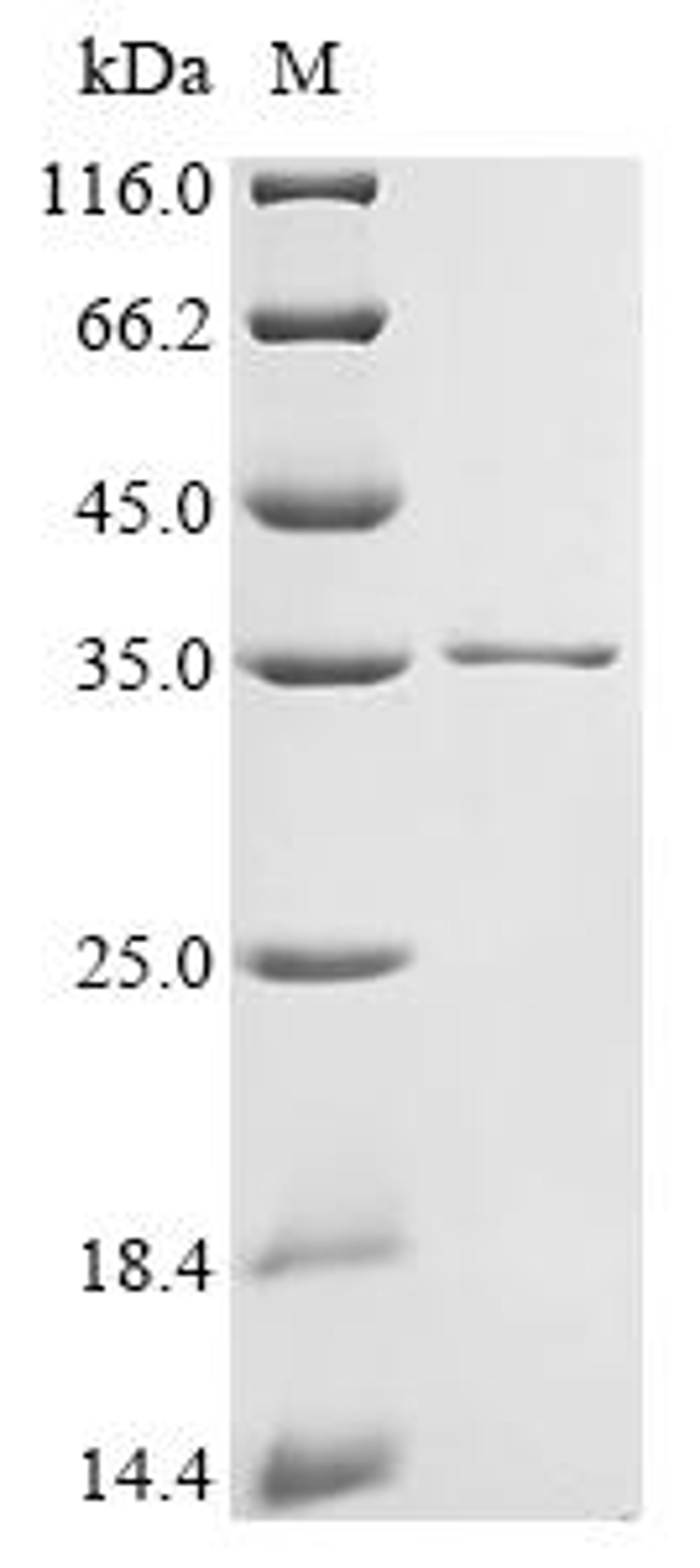 (Tris-Glycine gel) Discontinuous SDS-PAGE (reduced) with 5% enrichment gel and 15% separation gel.
