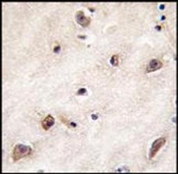 Immunohistochemical staining of paraffin embedded human brain tissue using GDF1 antibody (primary antibody dilution at: 1:10-50)