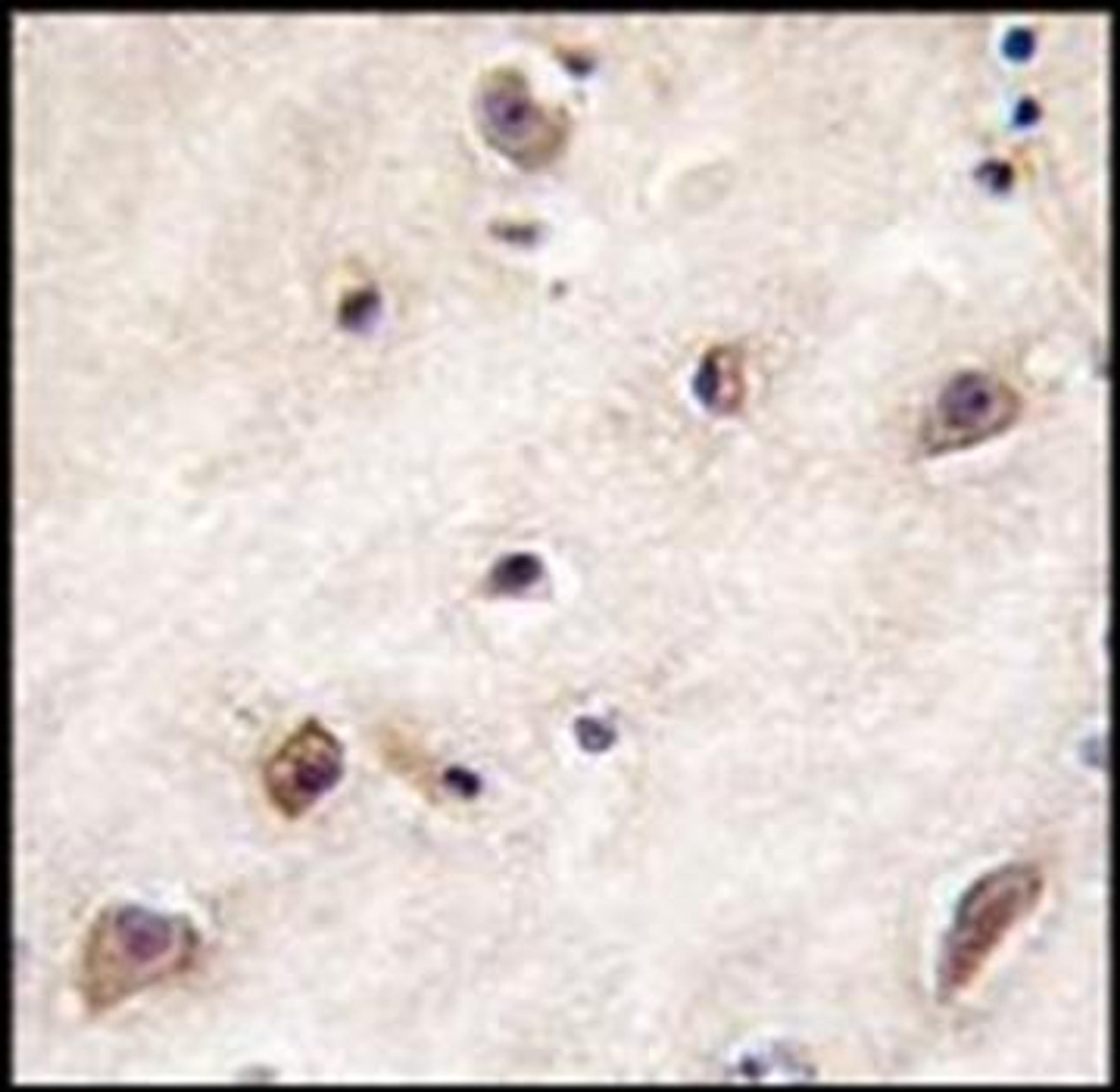 Immunohistochemical staining of paraffin embedded human brain tissue using GDF1 antibody (primary antibody dilution at: 1:10-50)