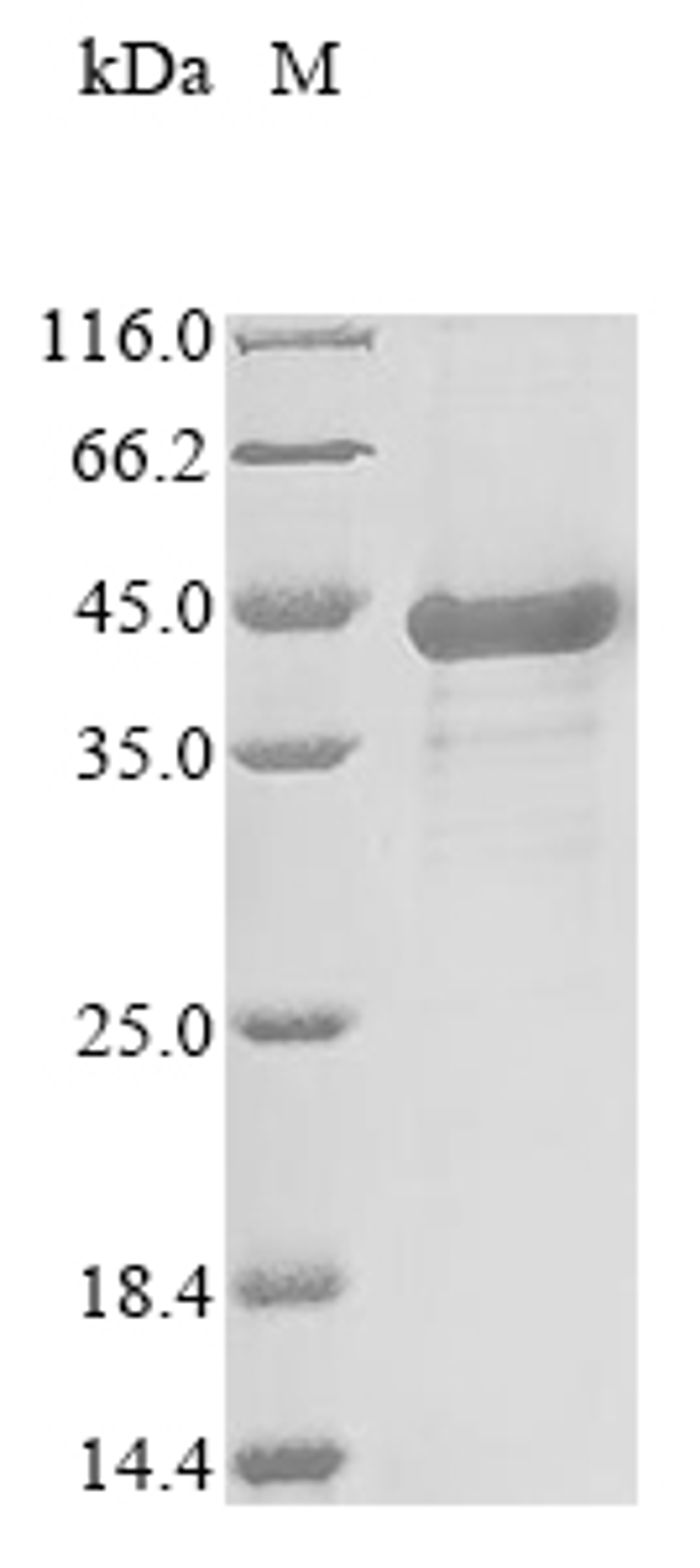 (Tris-Glycine gel) Discontinuous SDS-PAGE (reduced) with 5% enrichment gel and 15% separation gel.